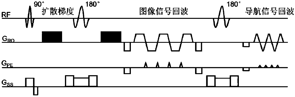 MRI data compression and accelerated reconstruction method