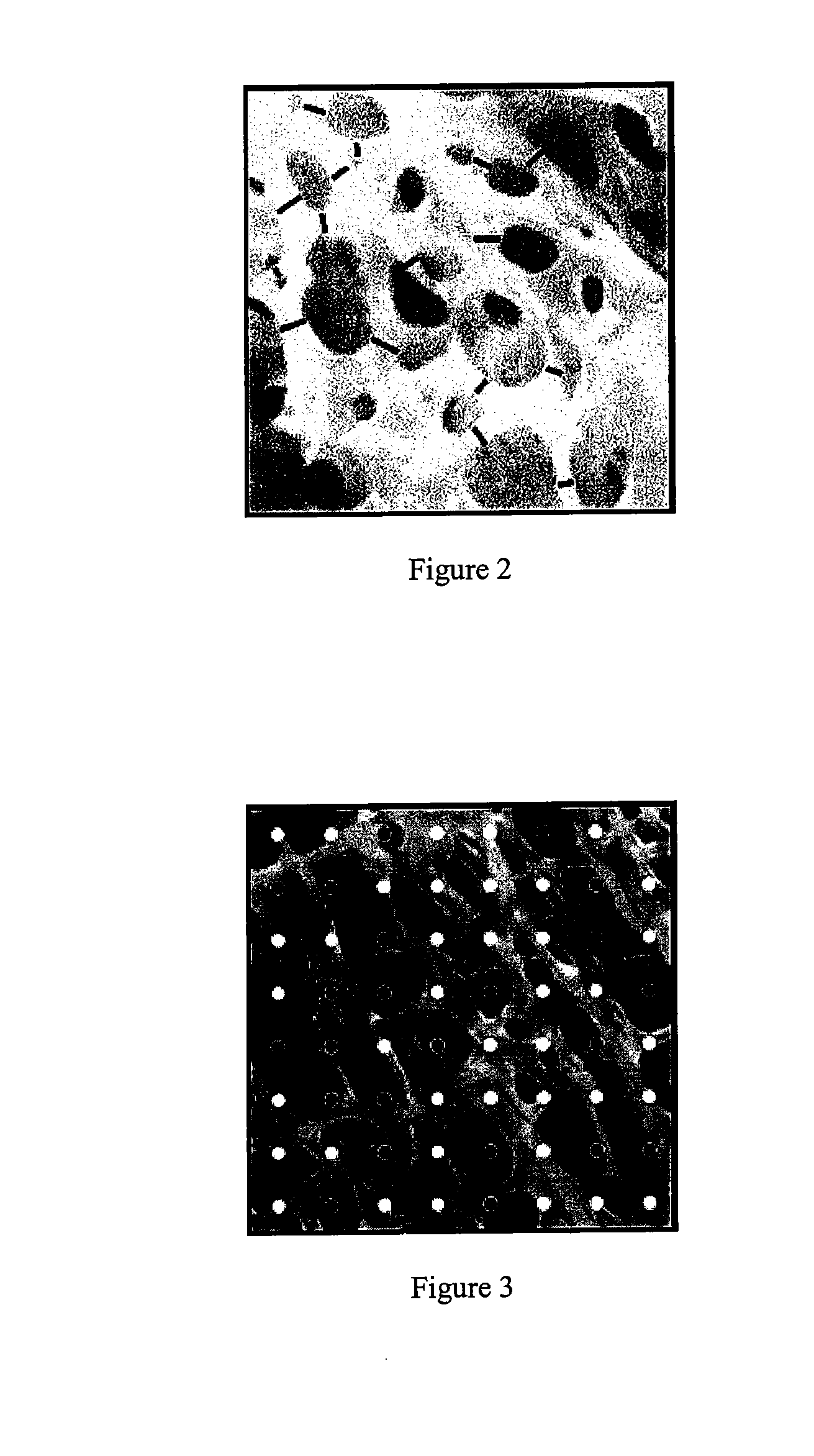 Templates for assessing bone quality and methods of use thereof