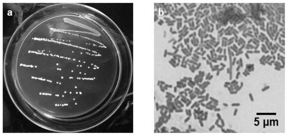 Lactobacillus fermentum for producing bacteriocin and application of lactobacillus fermentum in inhibiting production of albuginea in fermented food