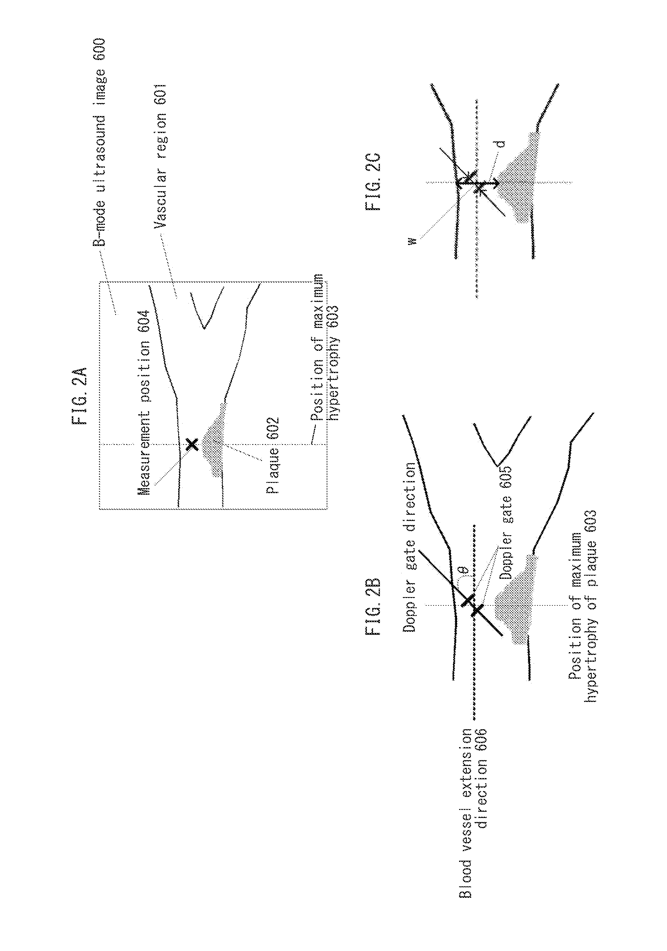 Ultrasound diagnostic apparatus and method for controlling the same
