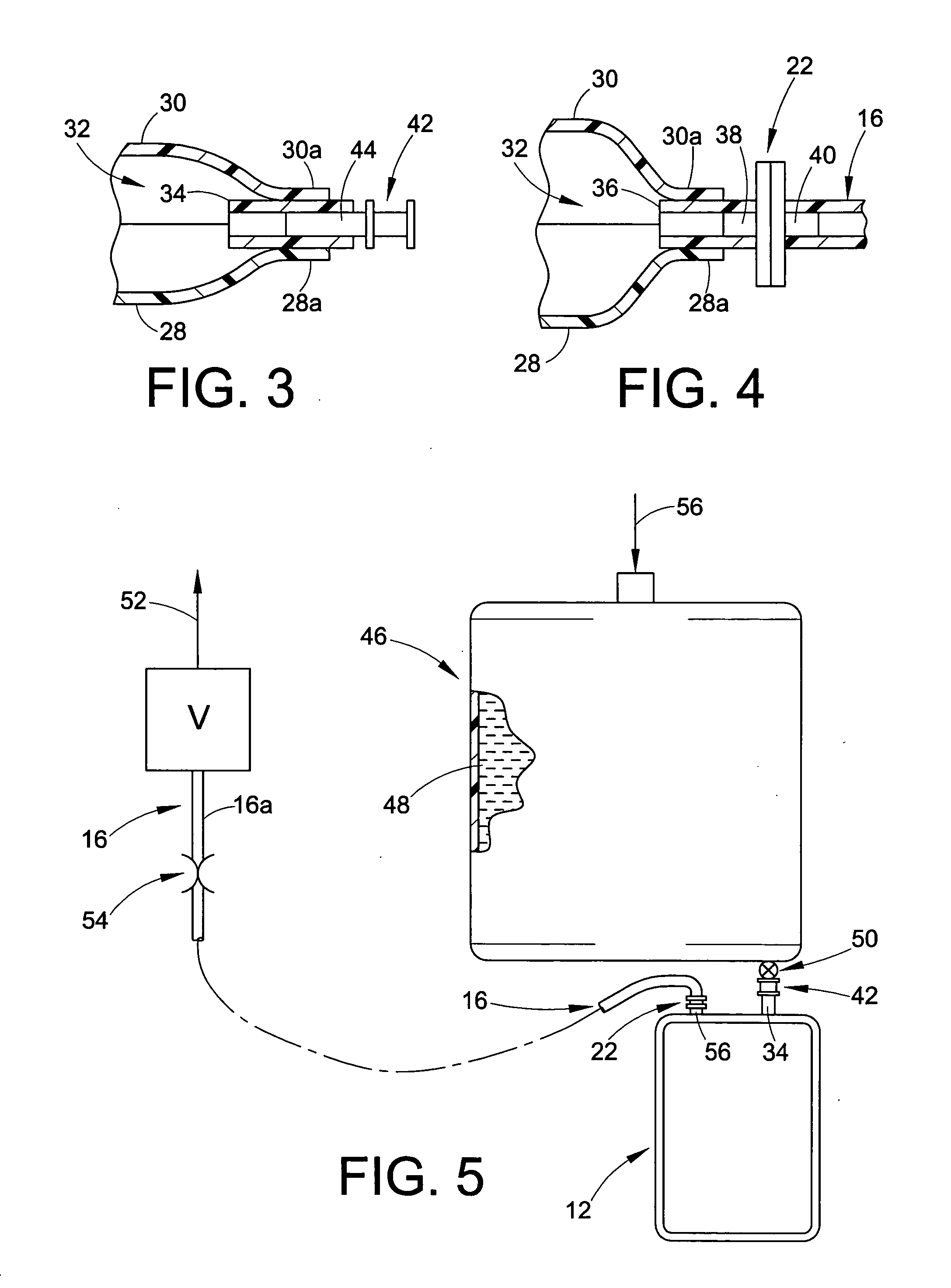 External ink supply bag and method of filling the same