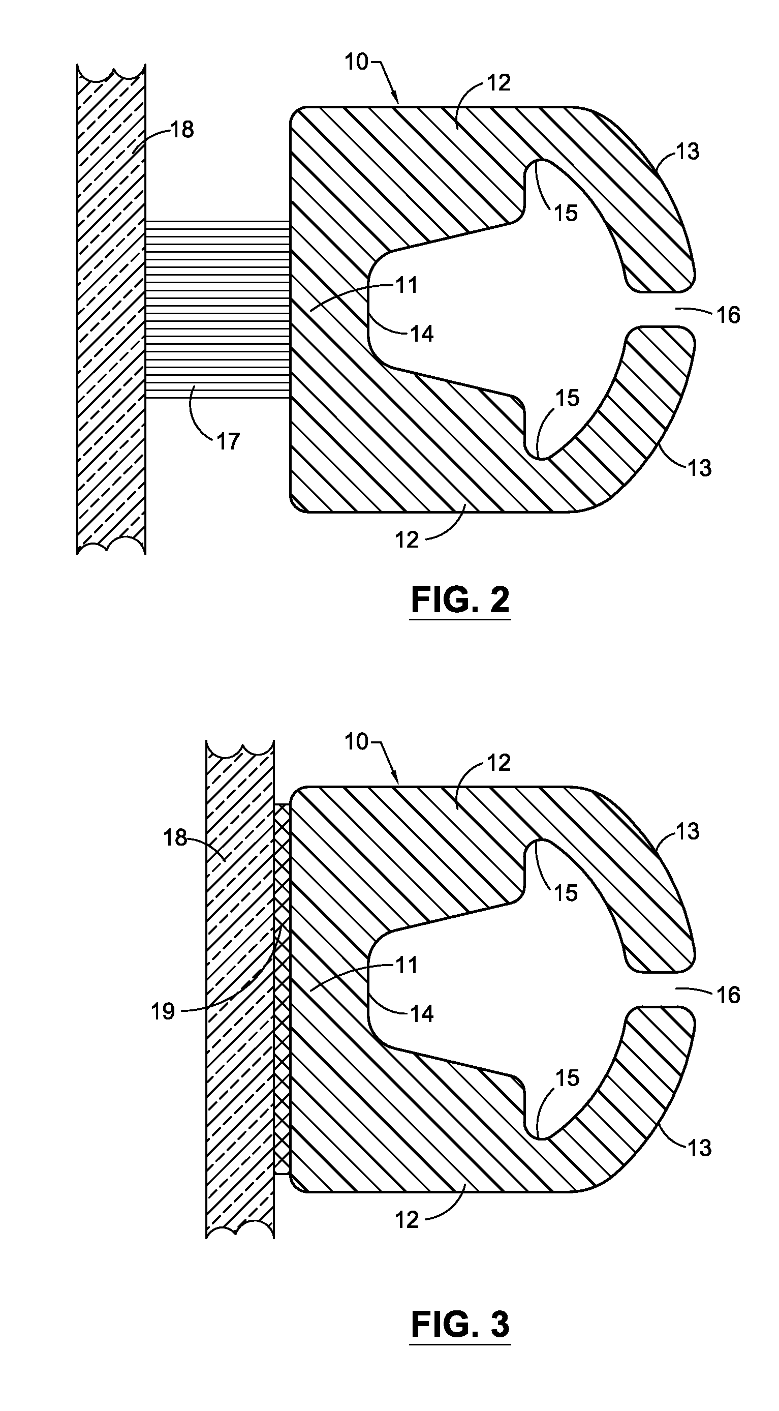 Temporary Scrubbing Appendage For A Windshield Wiper Assembly