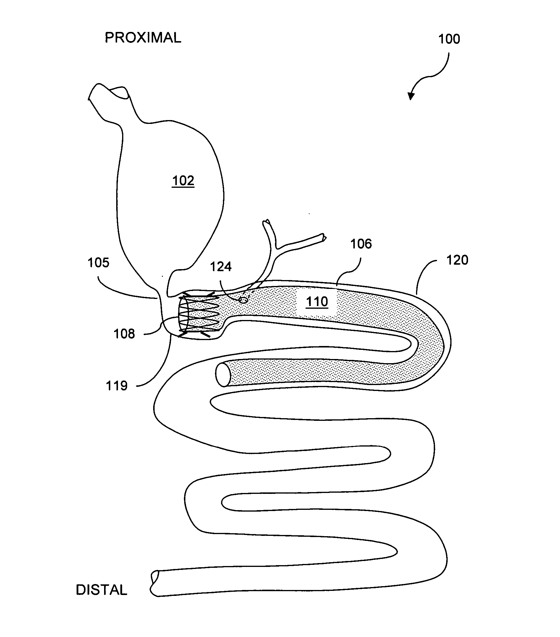Methods and apparatus for anchoring within the gastrointestinal tract