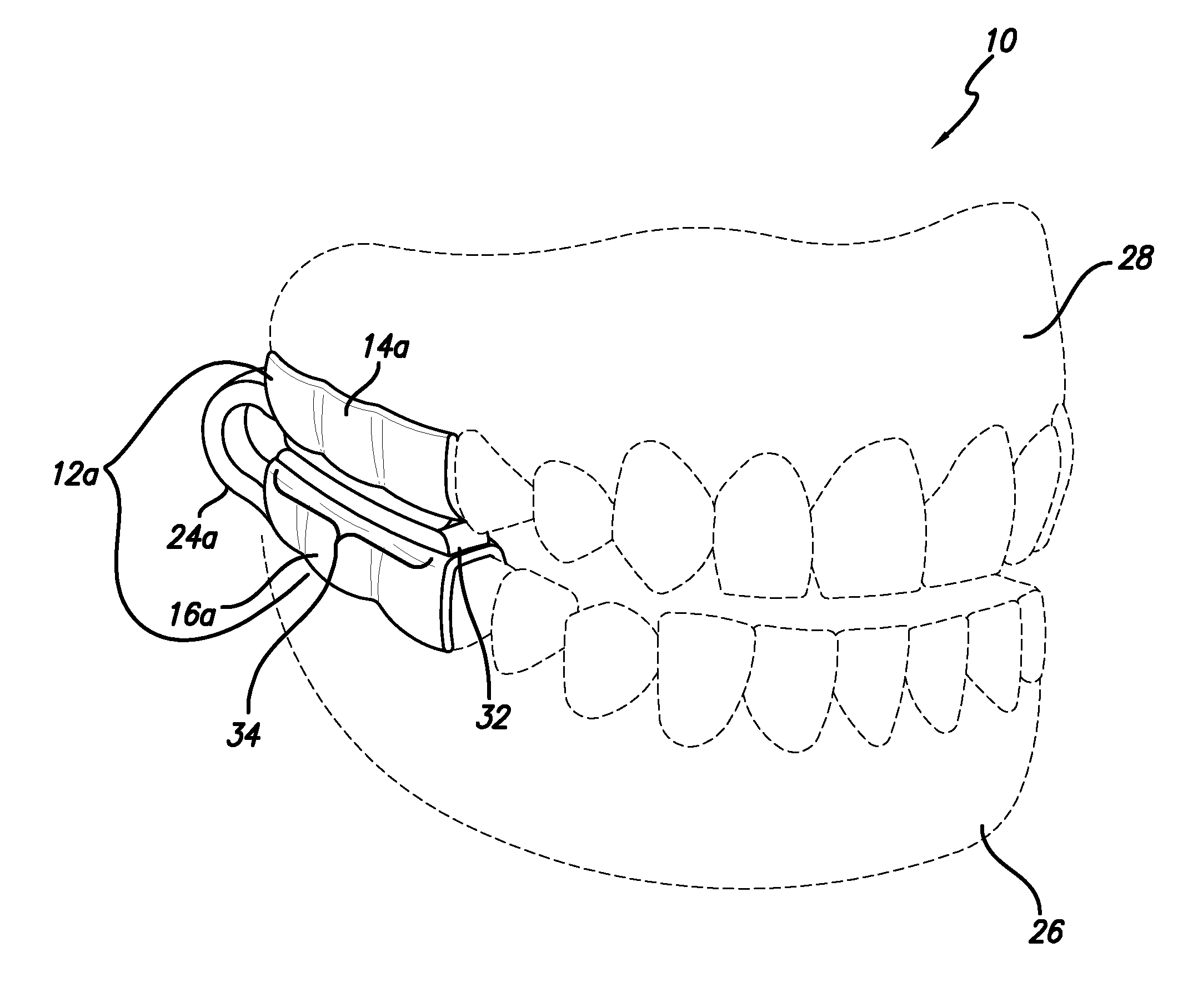 Dental appliance and methods of using the same