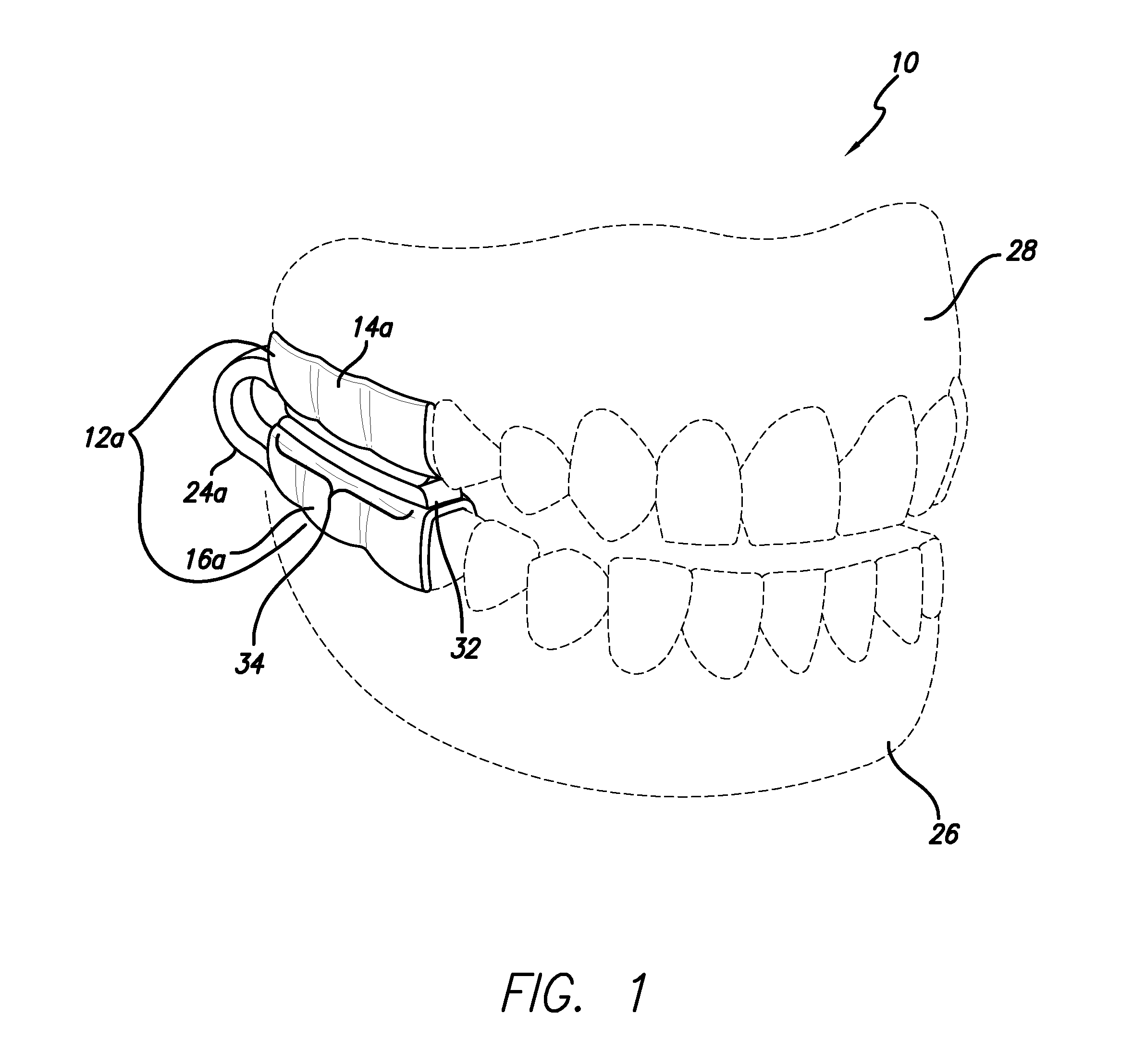 Dental appliance and methods of using the same