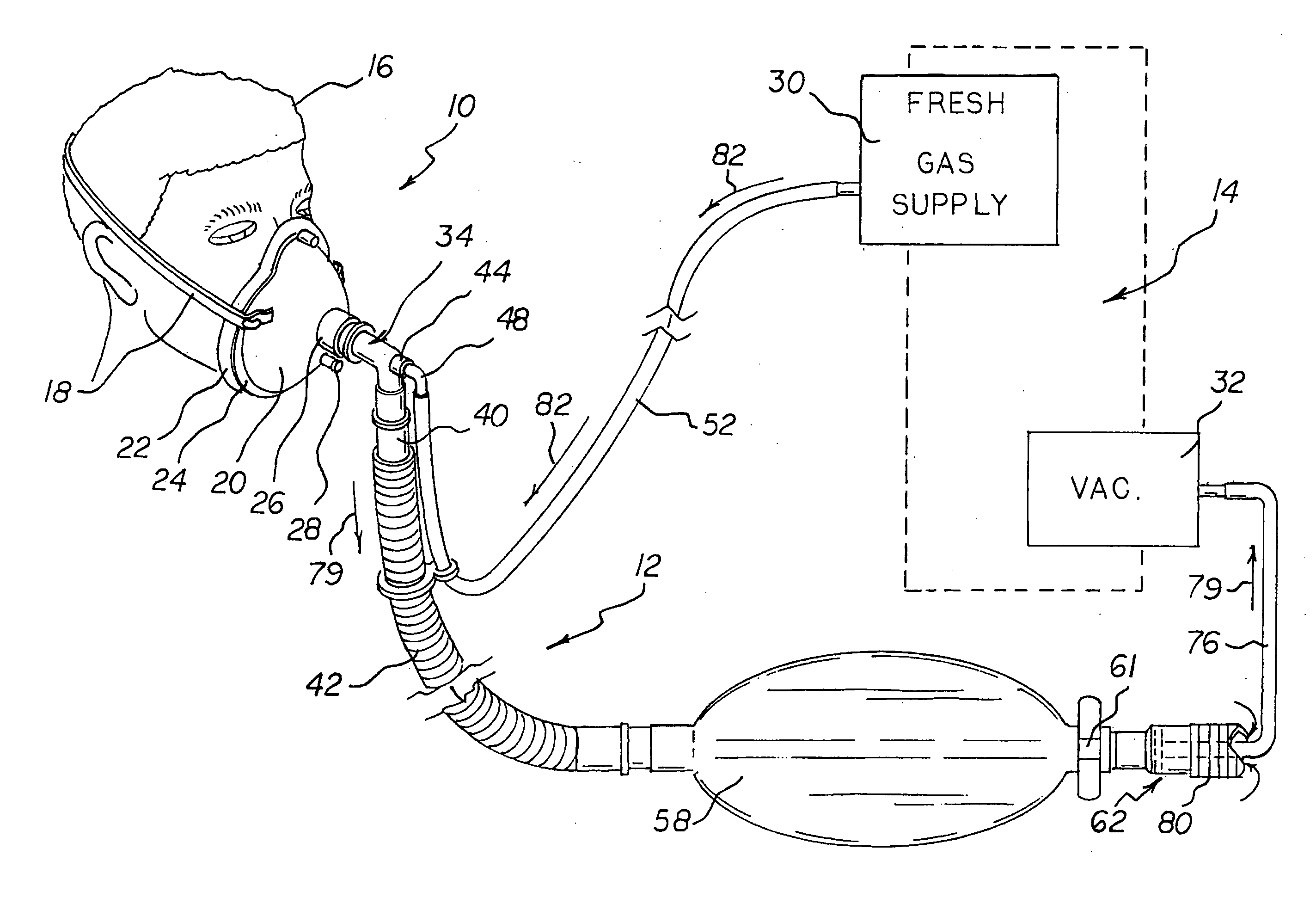 Respiratory face mask and breathing circuit assembly