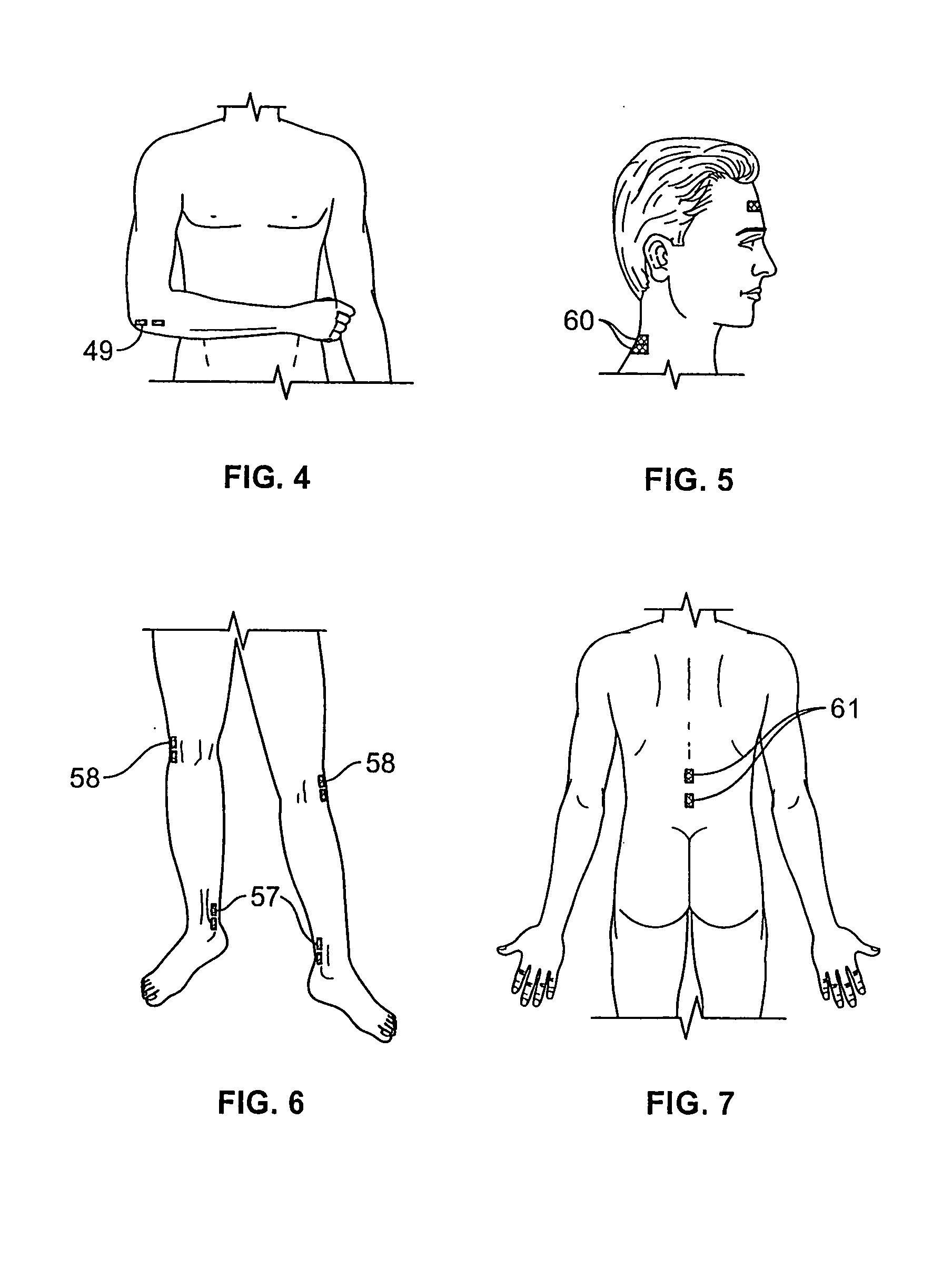 Methods & systems for intraoperatively monitoring nerve & muscle frequency latency and amplitude