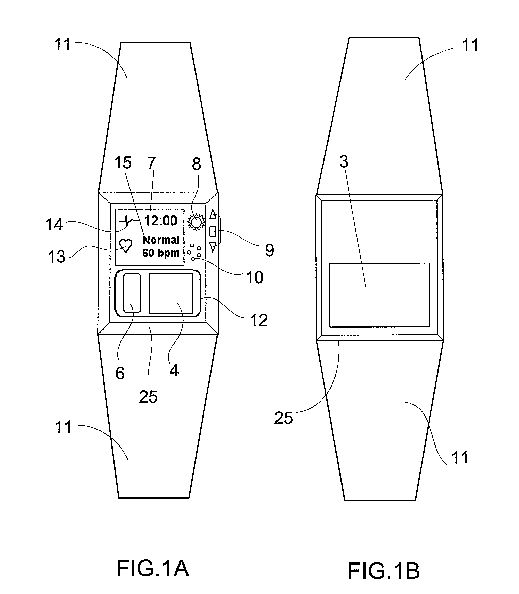 Device and Method for Measuring Three-Lead ECG in a Wristwatch