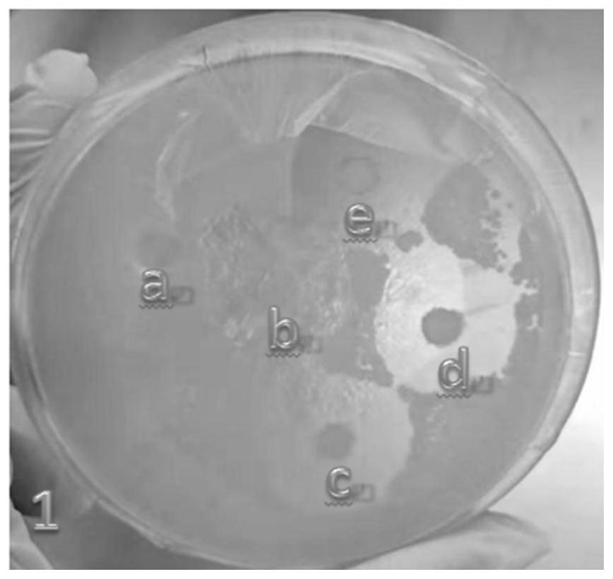 Antiallergic and antipruritic plant composition and its preparation method and application