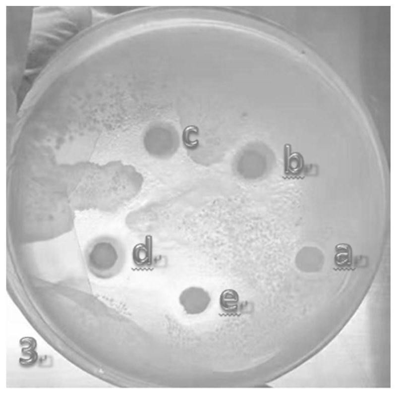 Antiallergic and antipruritic plant composition and its preparation method and application