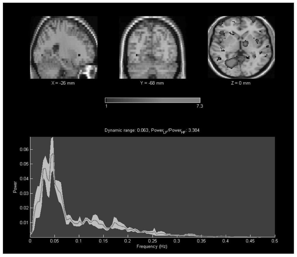 A fmri Time-Frequency Domain Dynamic Network Construction Method Based on Hilbert-Huang Transform