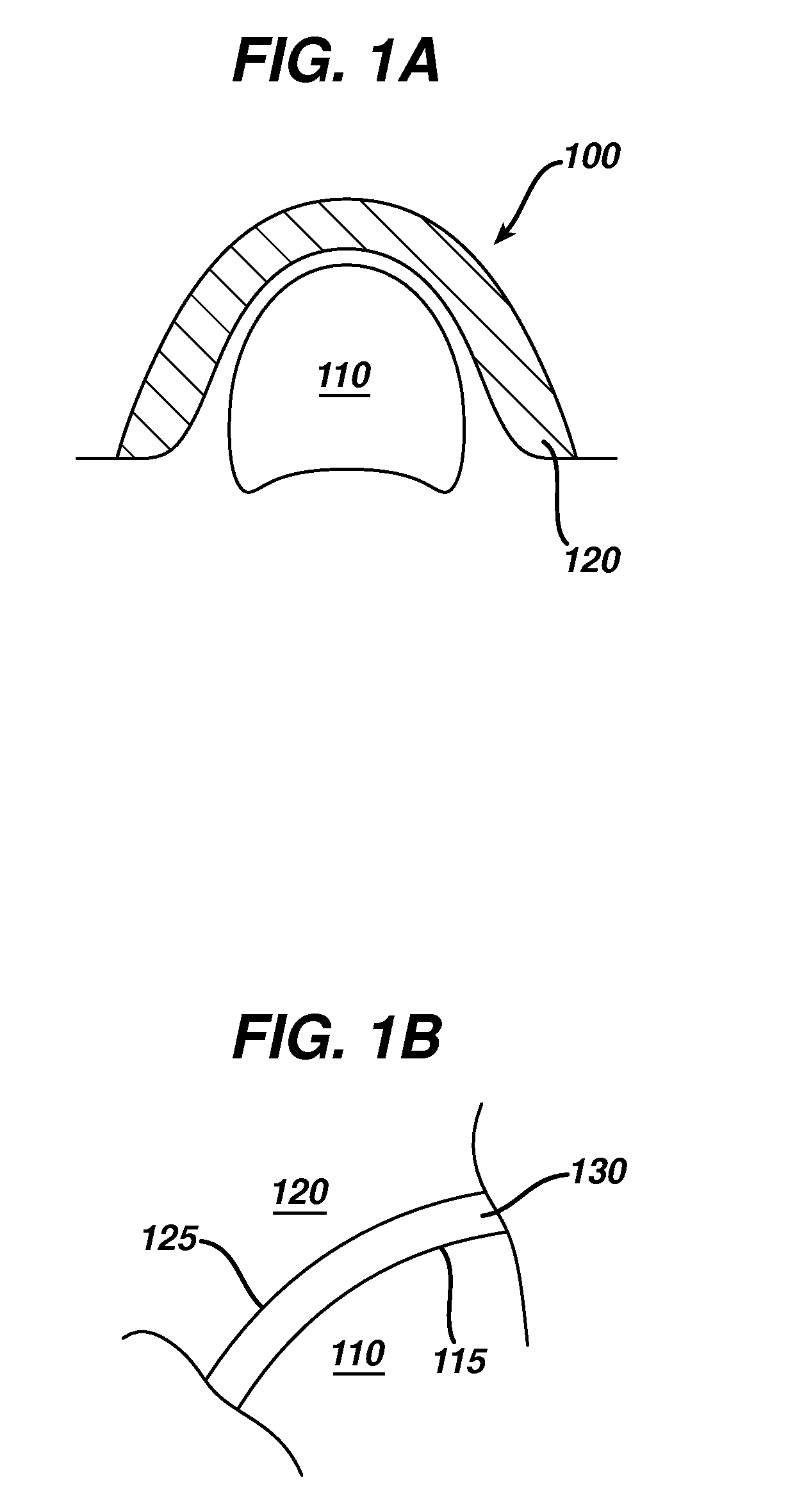 Implant surfaces and treatments for wear reduction