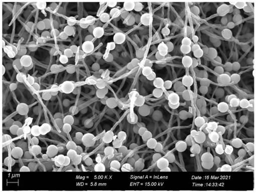 Preparation method of beaded carbon nanofiber-loaded titanium oxide photocatalyst