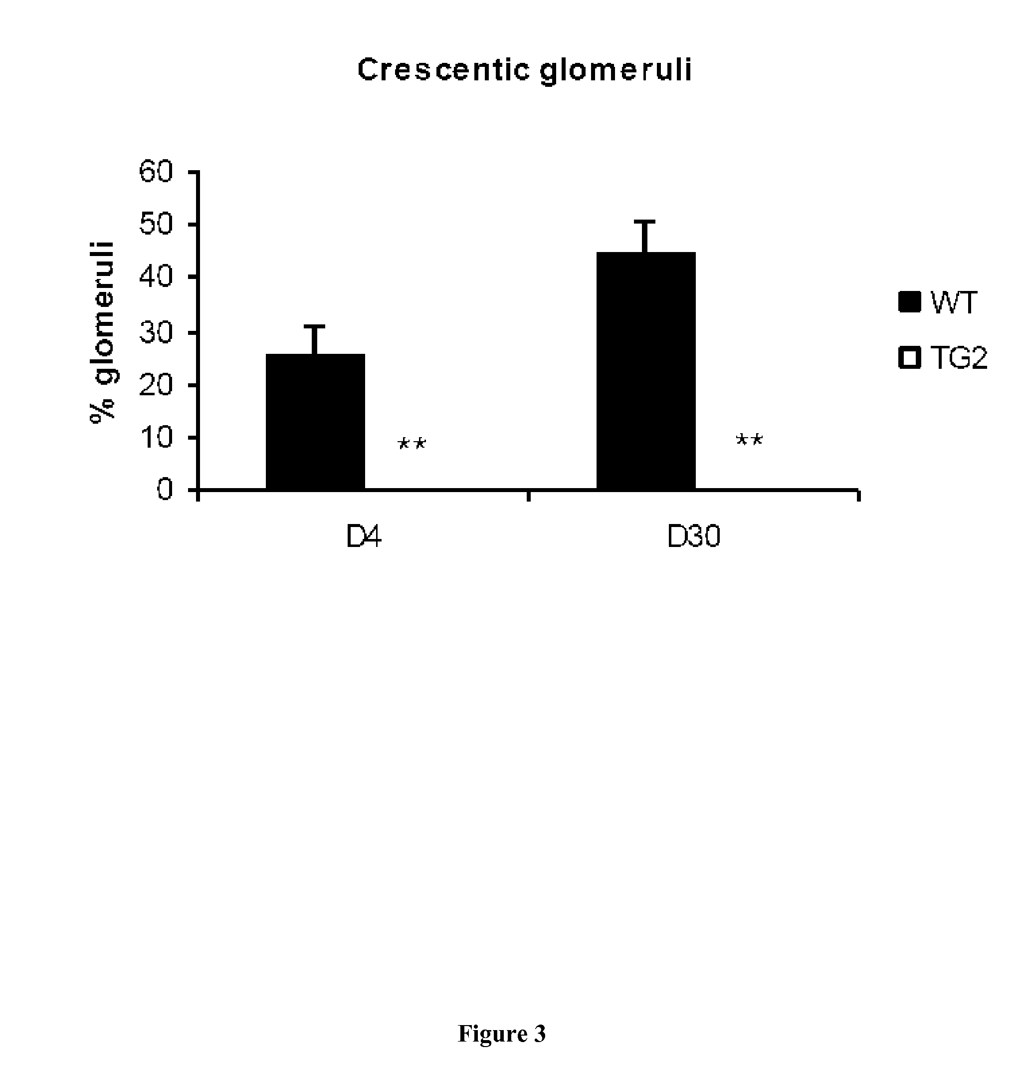 Transglutaminase 2 inhibitors for use in the prevention or treatment of rapidly progressive glomerulonephritis