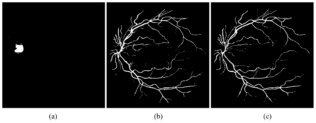 Fundus image blood vessel segmentation method