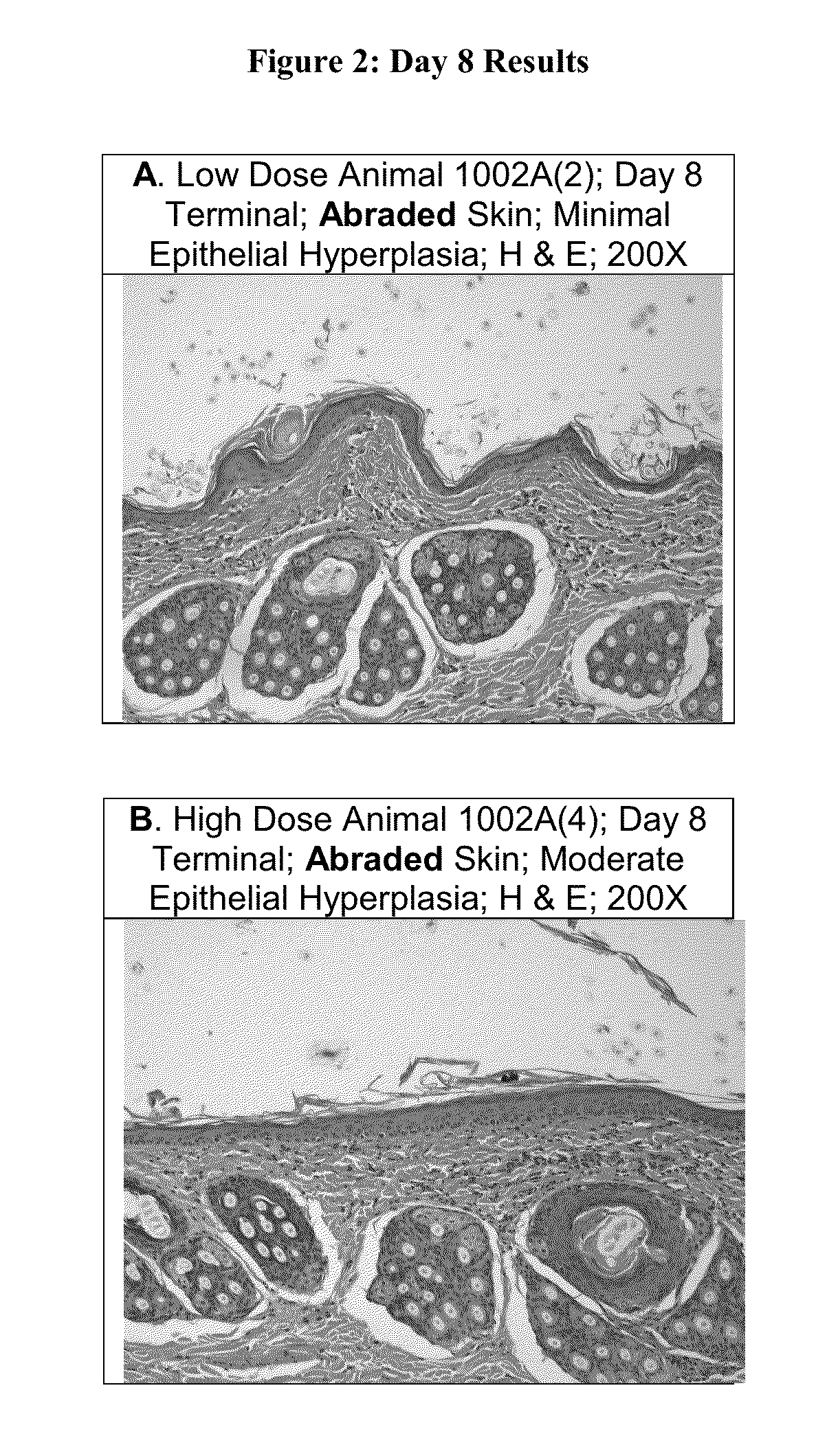 Enzyme compositions and use thereof for wound healing