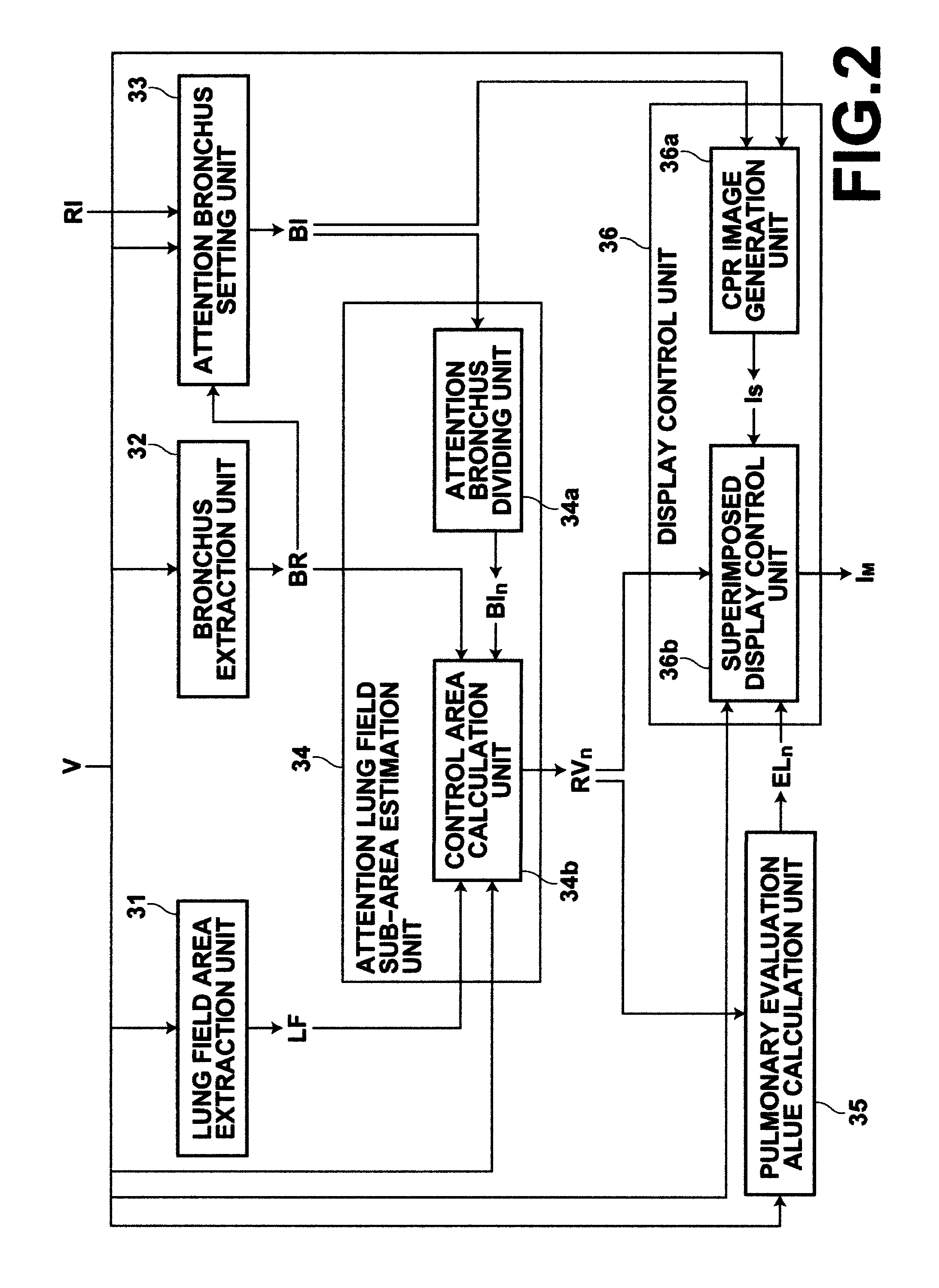 Medical image diagnosis assisting apparatus and method, and computer readable recording medium on which is recorded program for the same