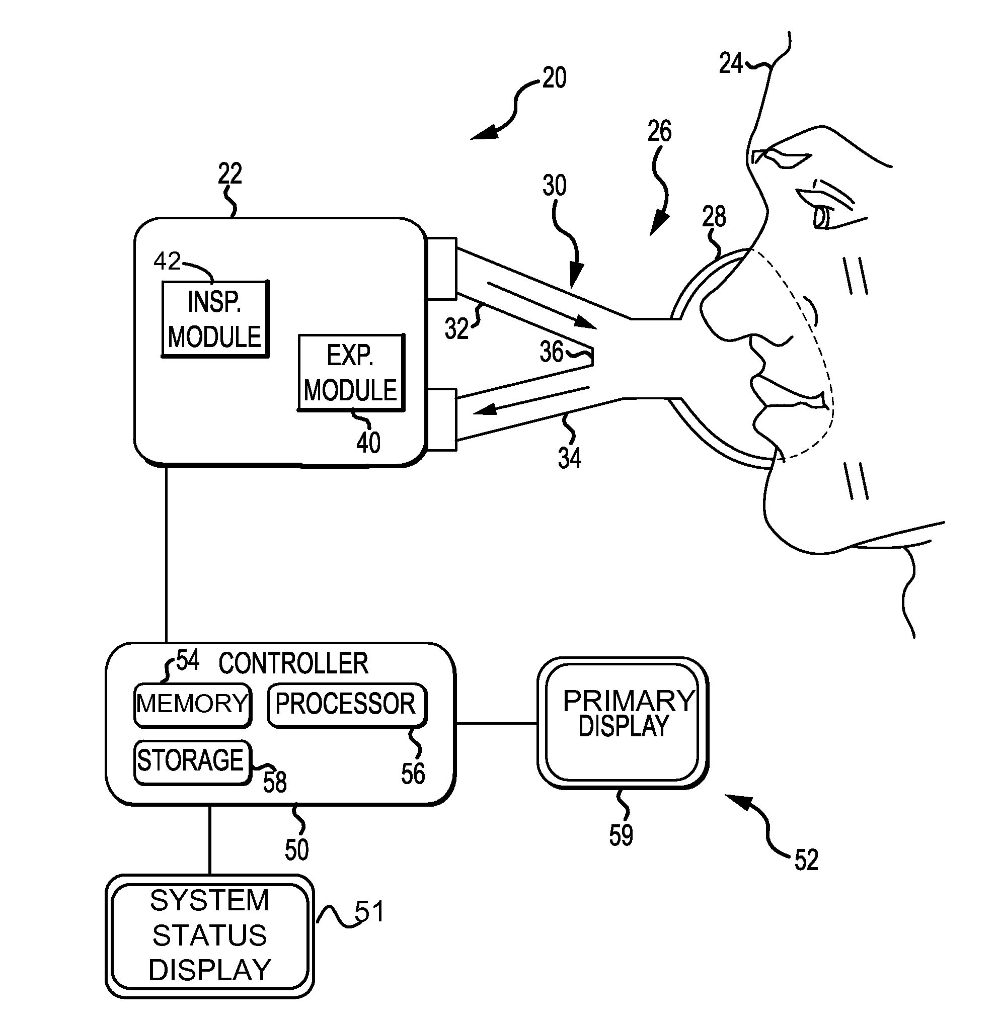 Ventilation System With Removable Primary Display