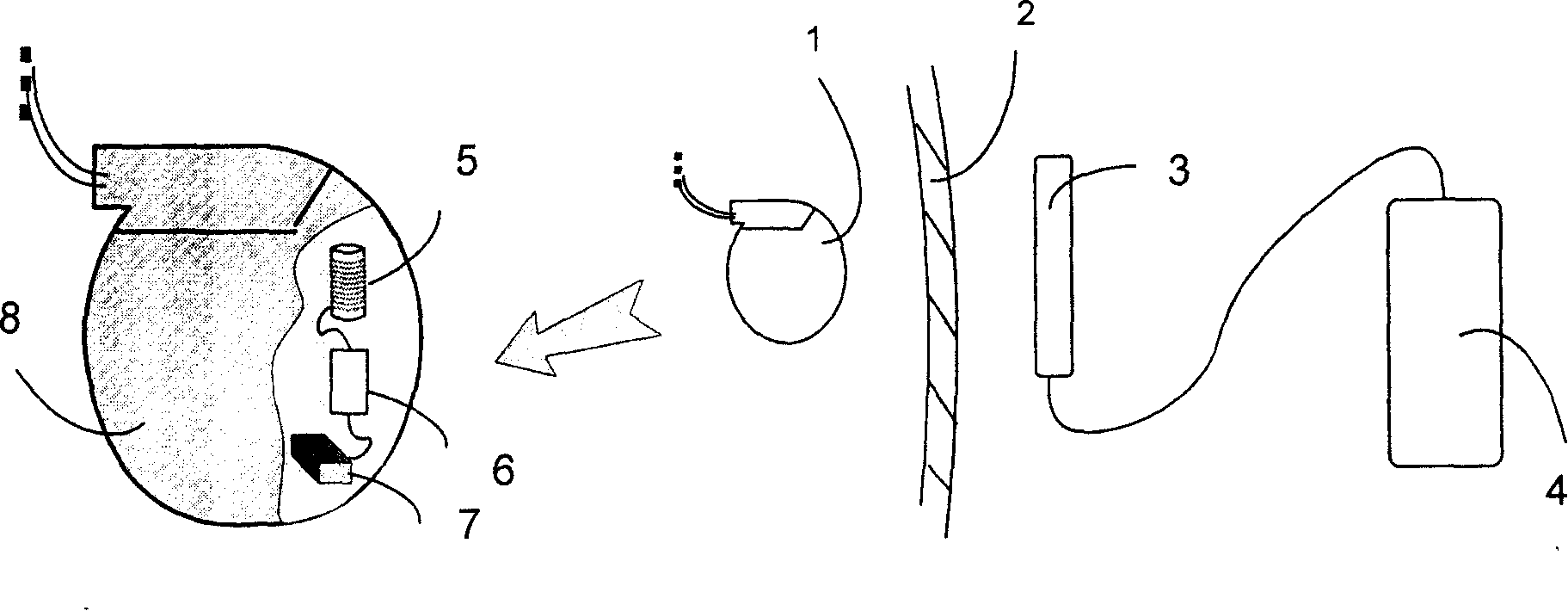 Wireless charging device through skin in use for implantation type medical treatment instrument