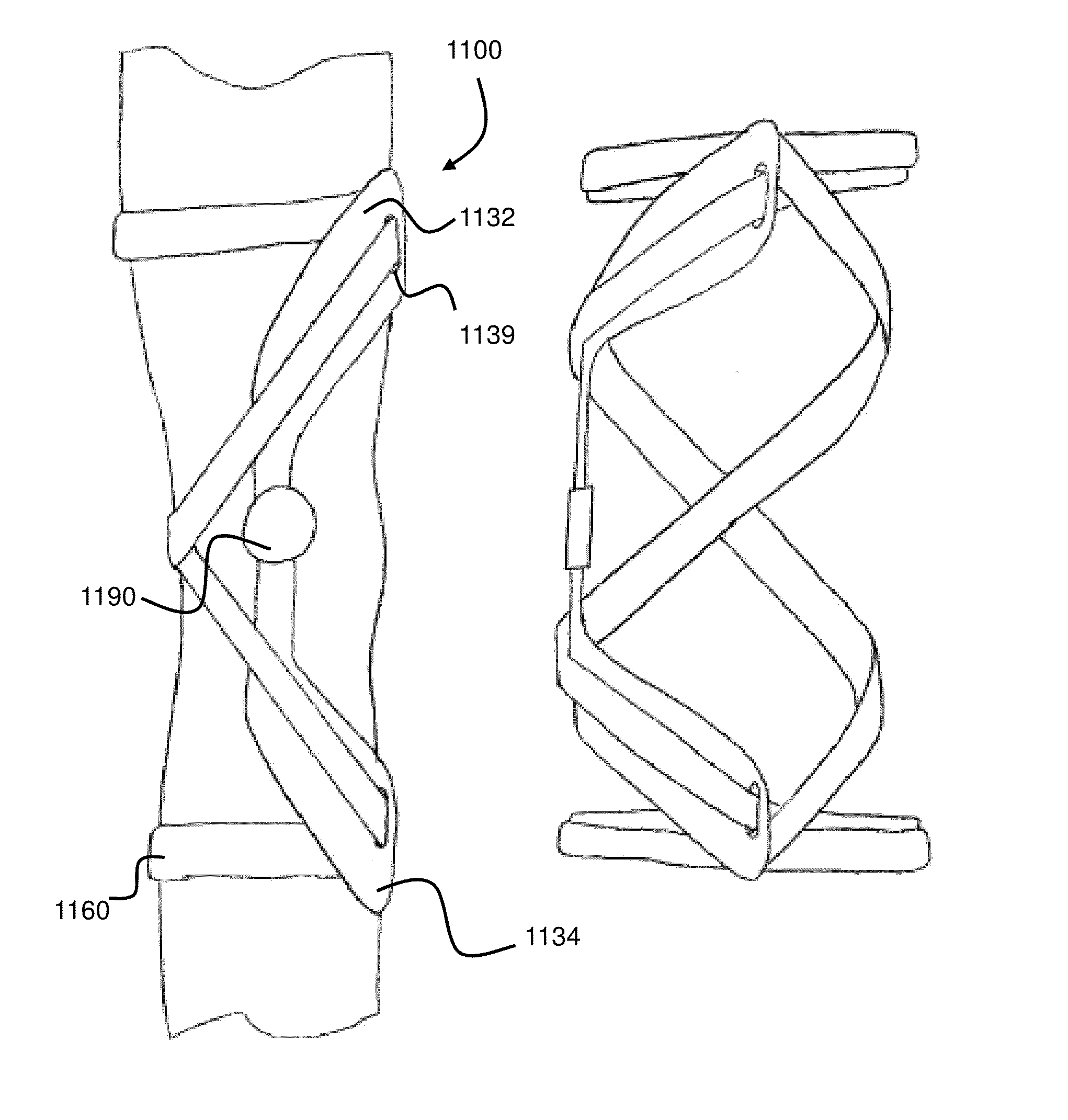Elastic brace assembly and methods of use