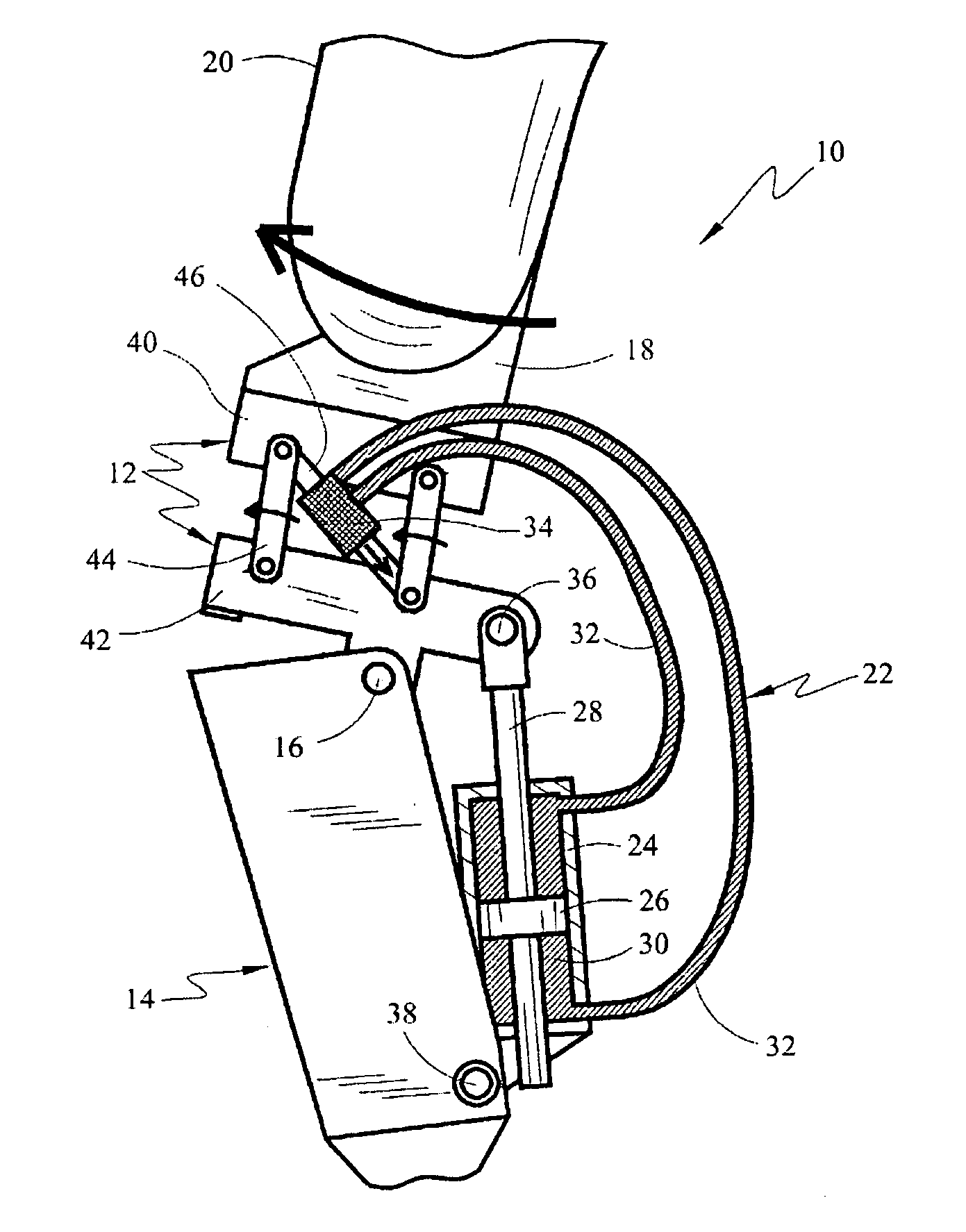 Above-knee prosthesis with variable resistance knee joint