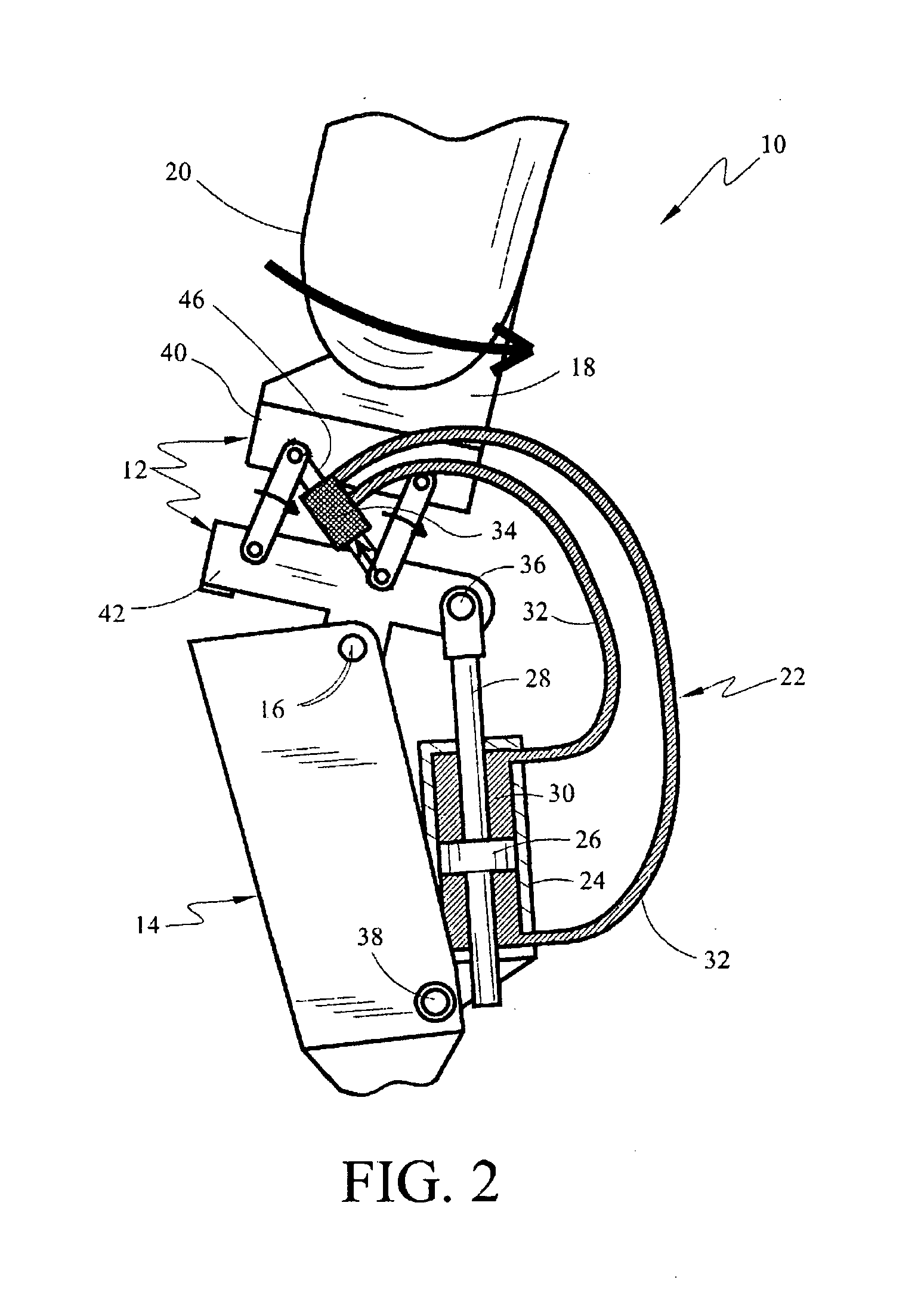 Above-knee prosthesis with variable resistance knee joint