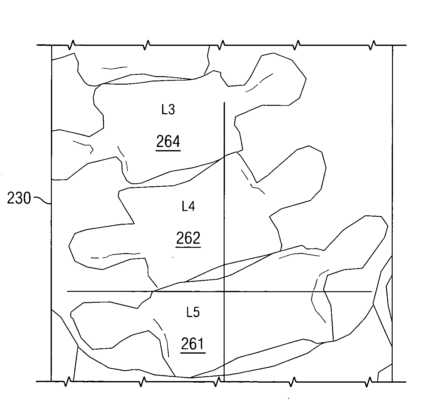 System and method of mapping images of the spine