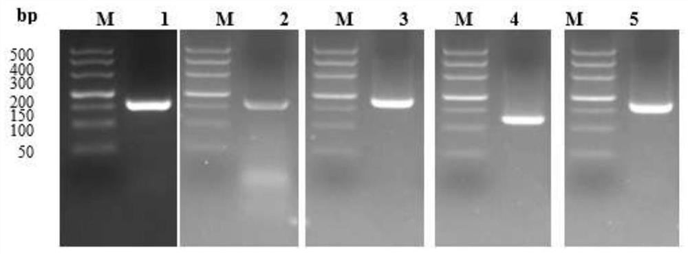 Composite antigen for detecting haemonchus contortus infection and application thereof