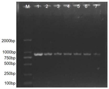 PCR detection primers for pantoea ananatis as pathogeny of bacterial wilt disease of mulberries and application