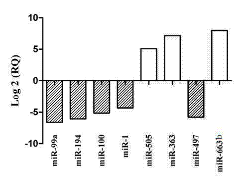Serum micro ribonucleic acid (miRNA) biomarker of bladder cancer and detection method of expression quantity thereof