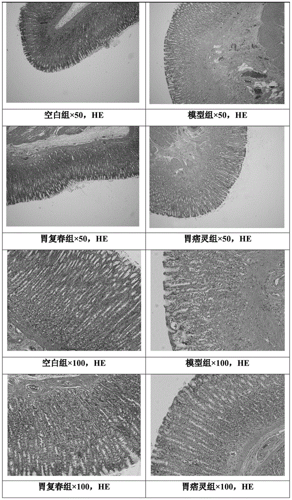 Traditional Chinese medicinal composition for treating chronic atrophic gastritis as well as preparation method and application thereof