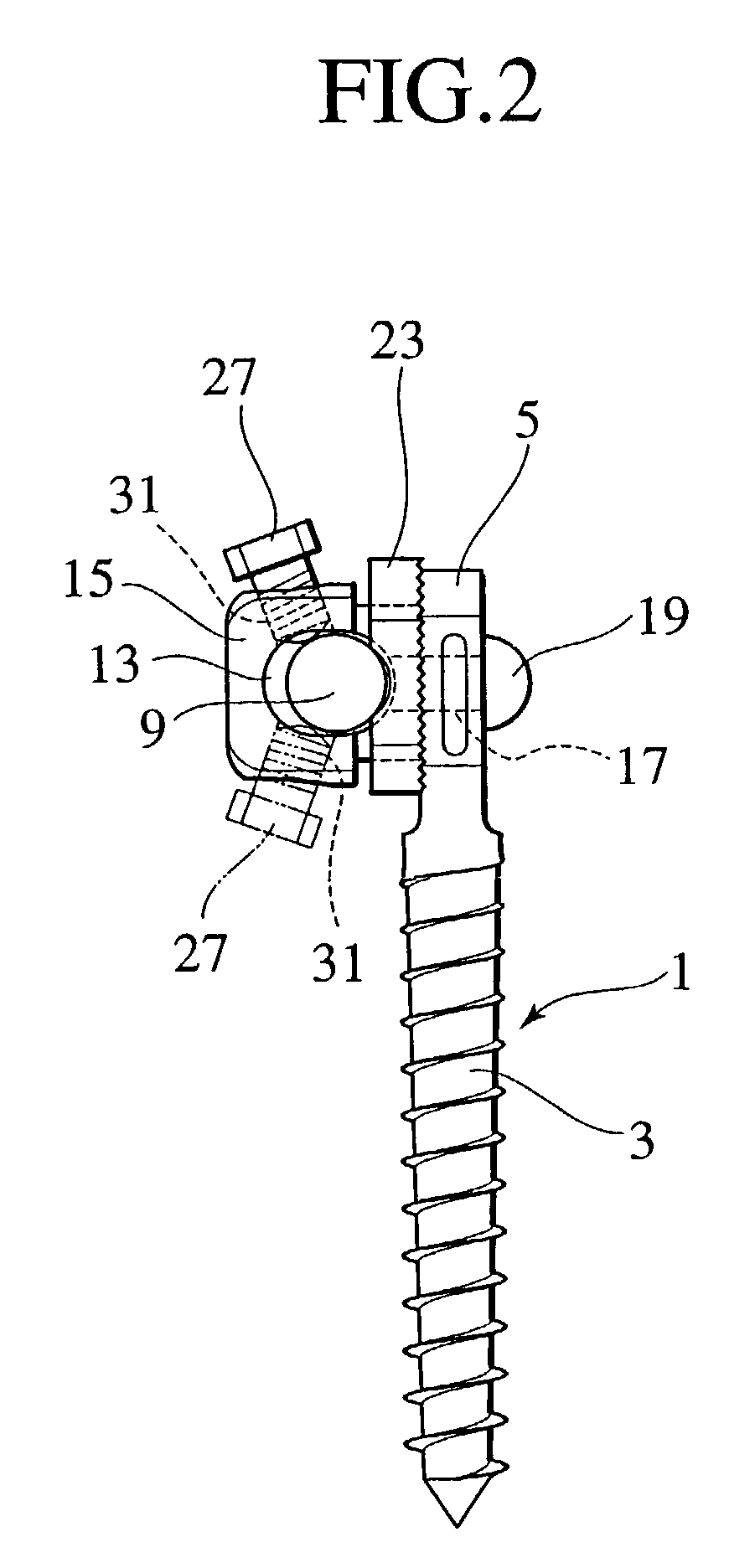 Rod for cervical vertebra and connecting system thereof