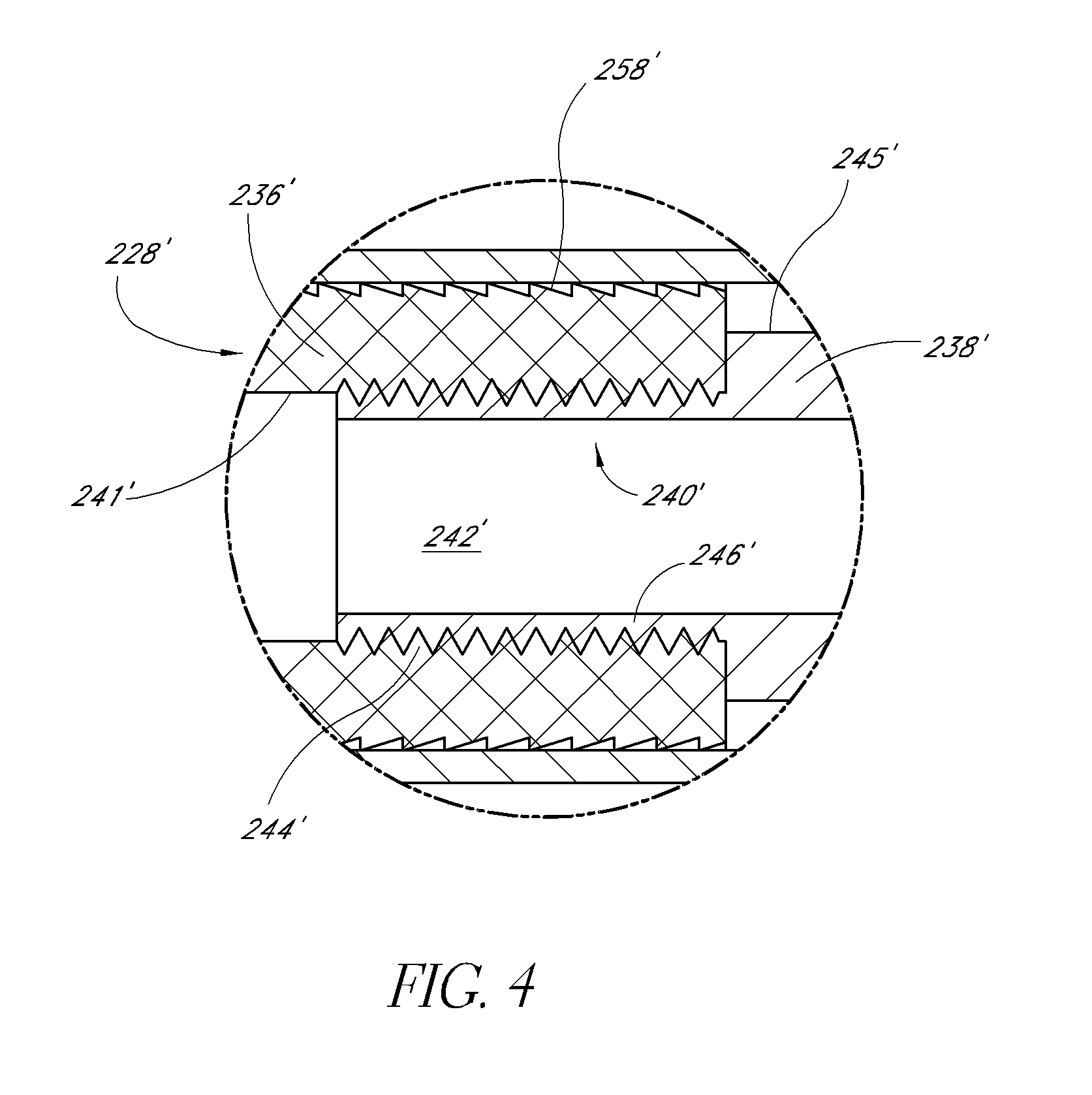 System and method for spinal fixation