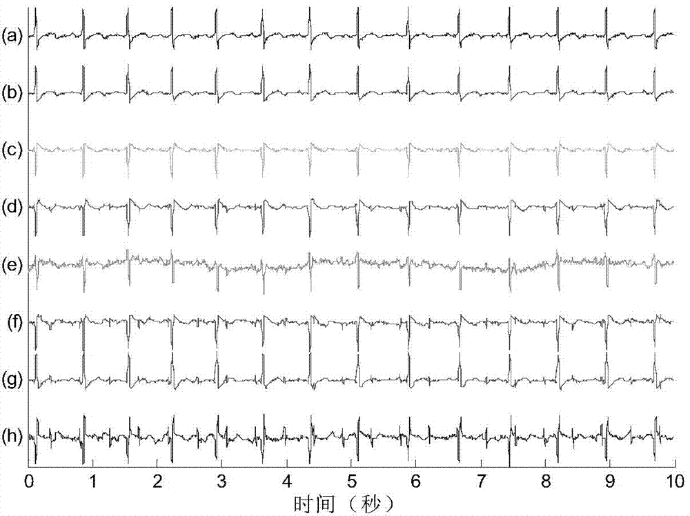 Blind extraction method for electrocatdiogram of mother and electrocardiogram of fetus based on second-order statistical properties