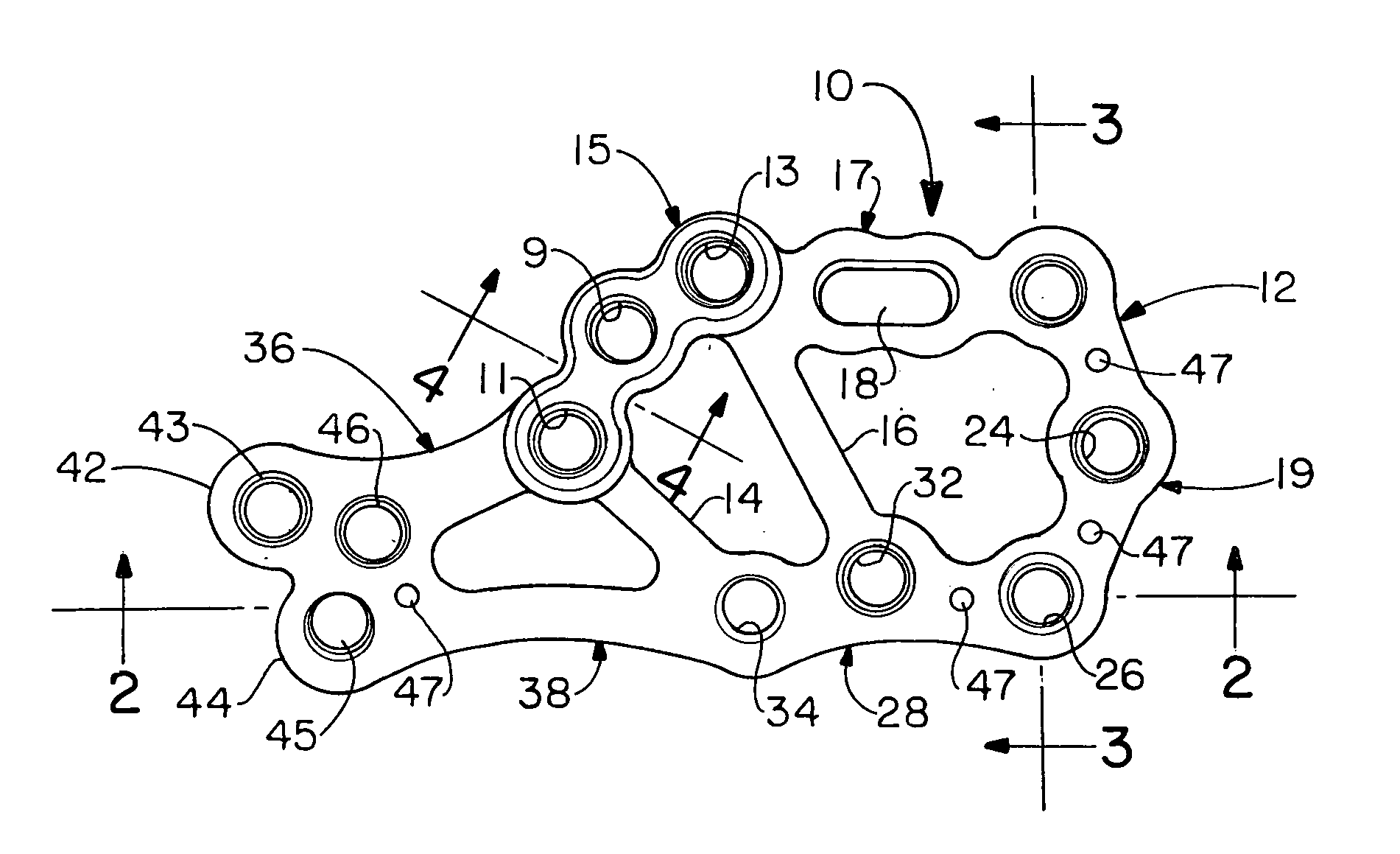 Calcaneal plate