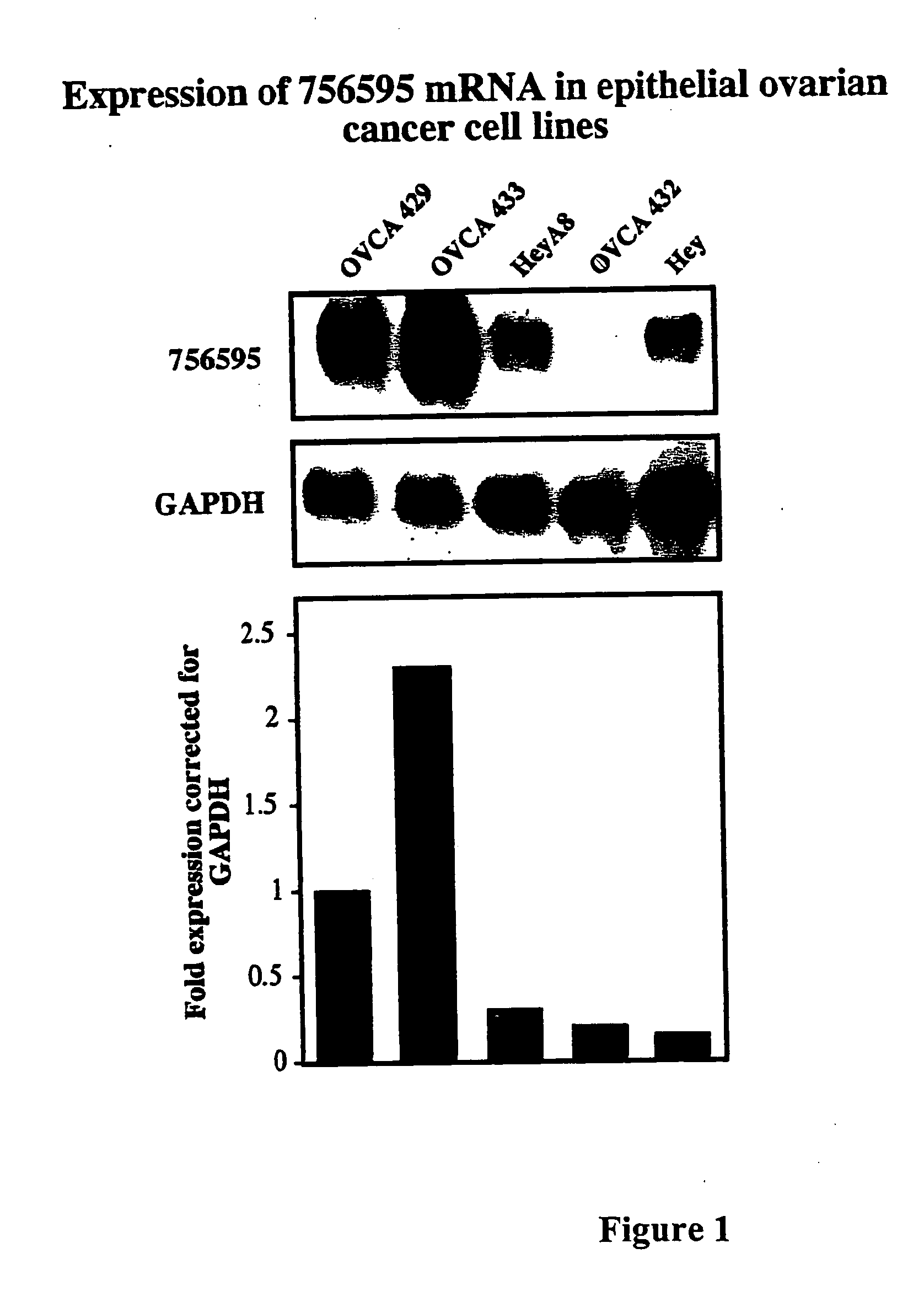 Methods for predicting and overcoming resistance to chemotherapy in ovarian cancer and for predicting colon cancer occurrence