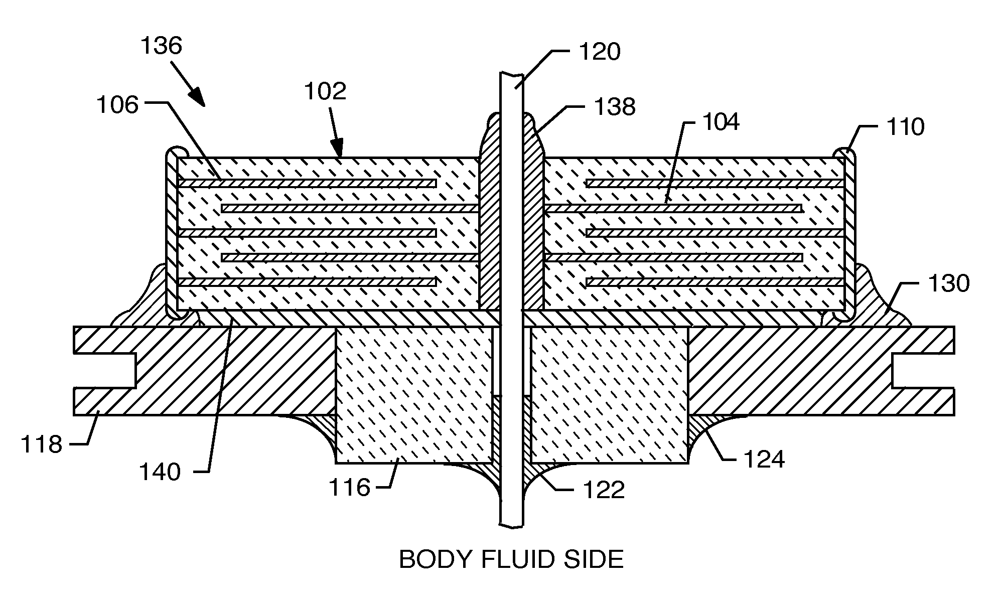 Electromagnetic interference filter and method for attaching a lead and/or a ferrule to capacitor electrodes