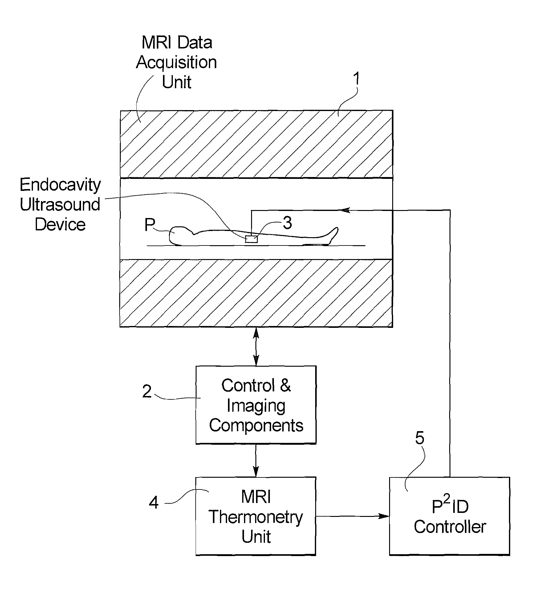 Method for temperature control in magnetic resonance-guided volumetric ultrasound therapy