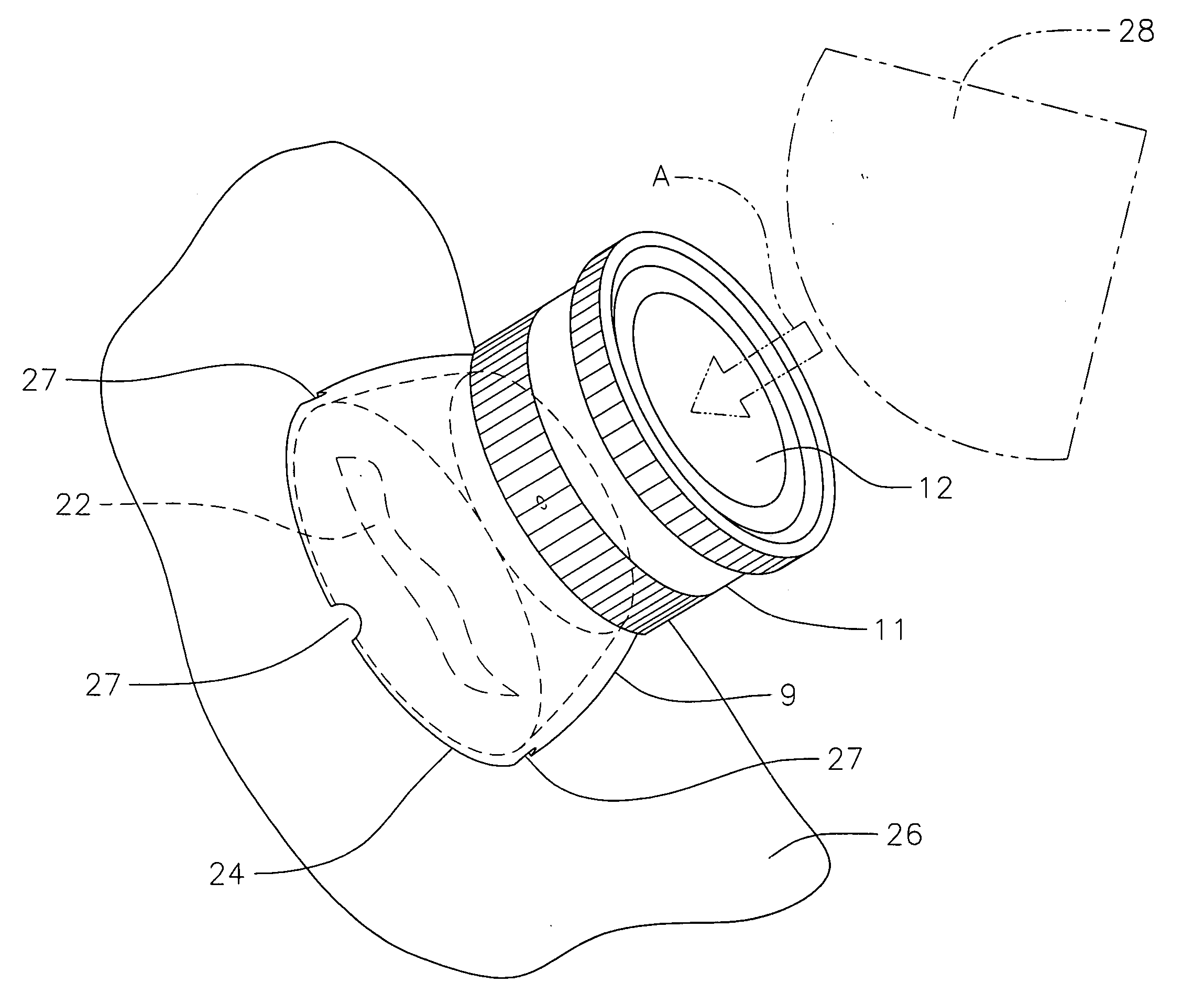 Device for irrigating and inspecting a wound