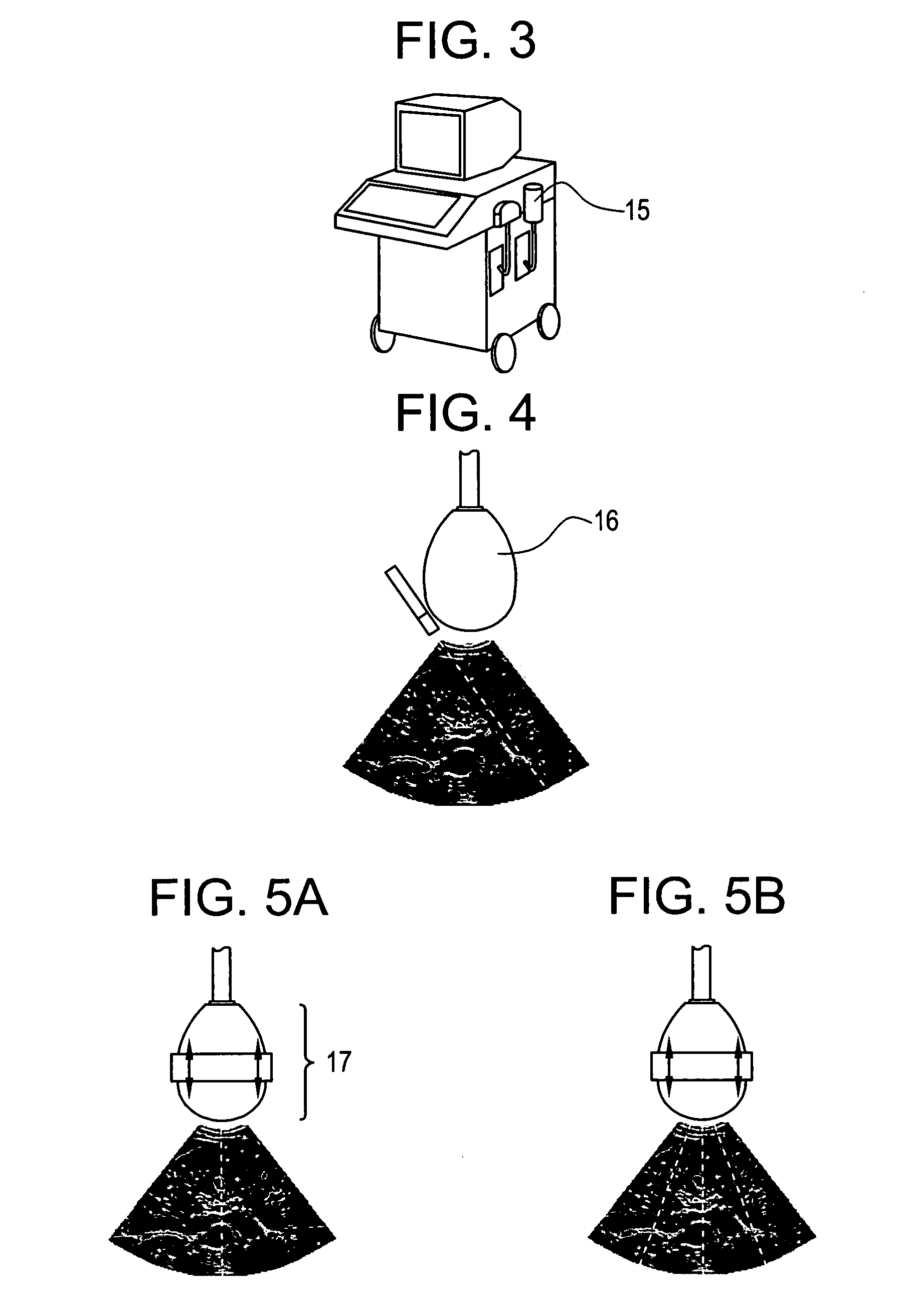 Device and method for measuring the elasticity of a human or animal organ