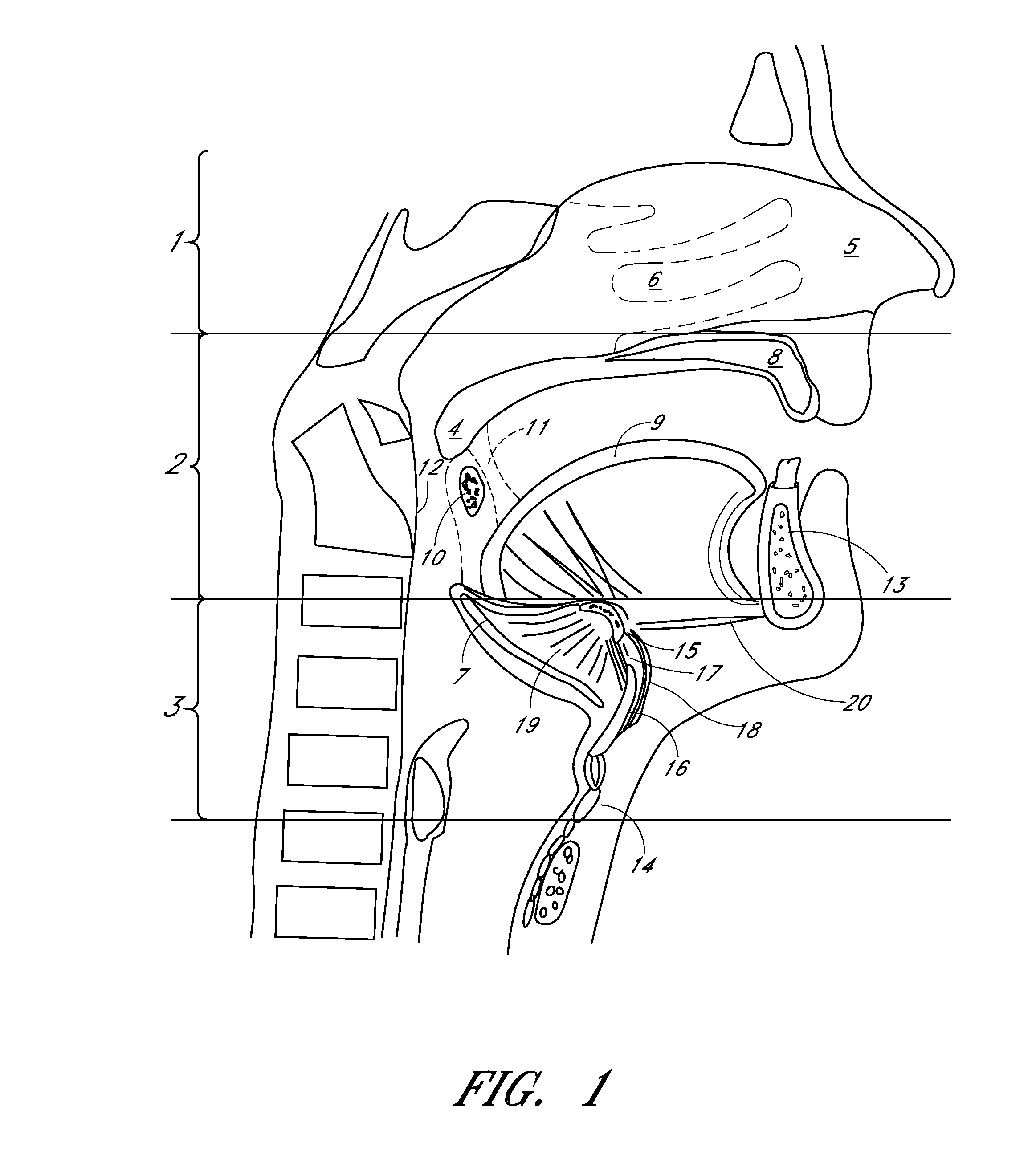 Glossopexy adjustment system and method