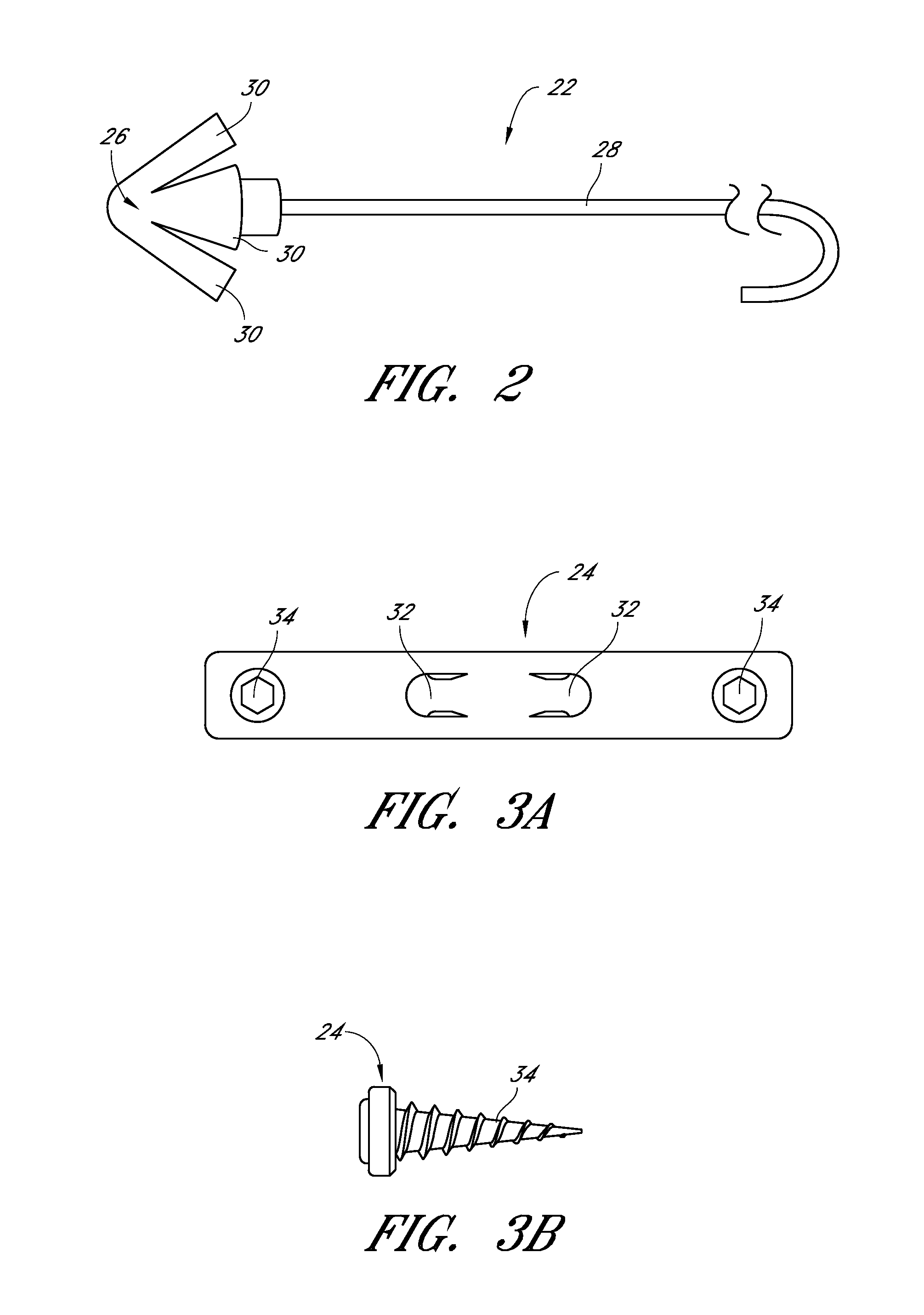 Glossopexy adjustment system and method