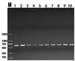 16S rDNA amplicon library building method for gestational diabetes mellitus intestinal flora detection