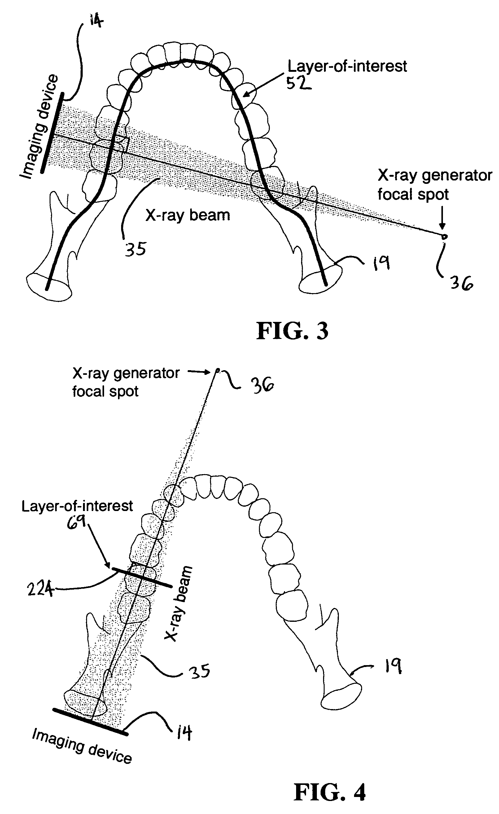 Dental extra-oral x-ray imaging system and method
