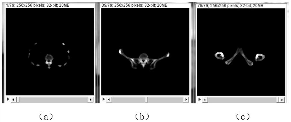 A method and system for reconstructing a bone tomographic image
