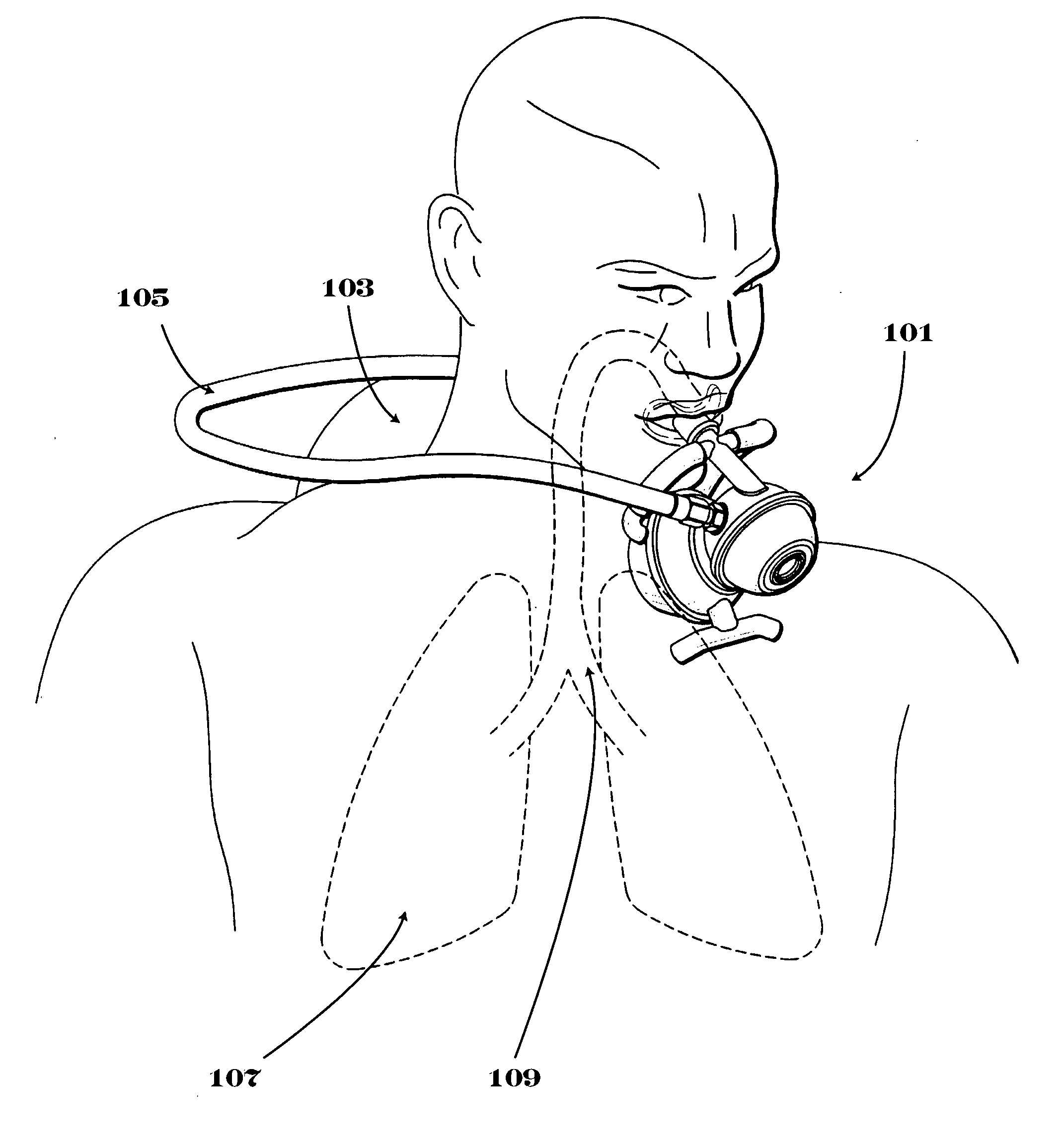 Second stage regulator