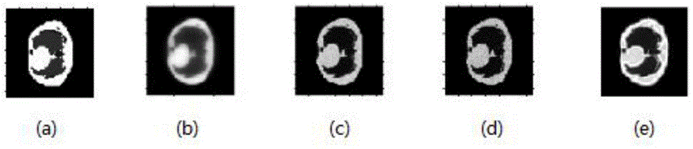 Dynamic PET image reconstruction method based on self-encoder image fusion