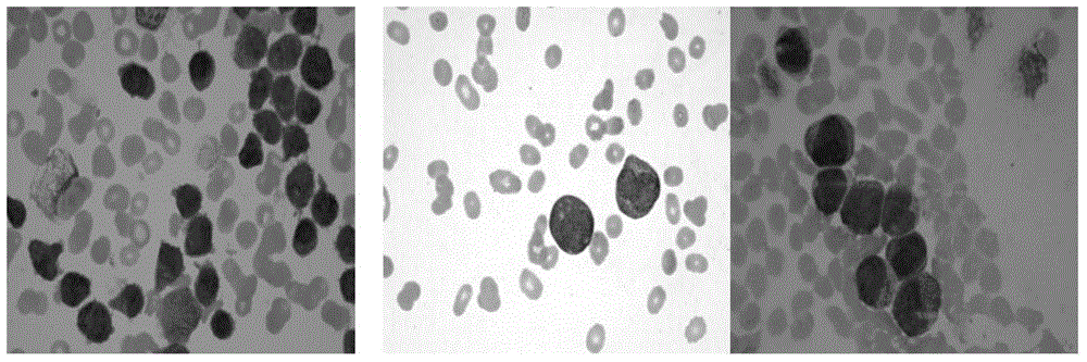 AML cell segmentation method based on Meanshift cluster and morphological operations