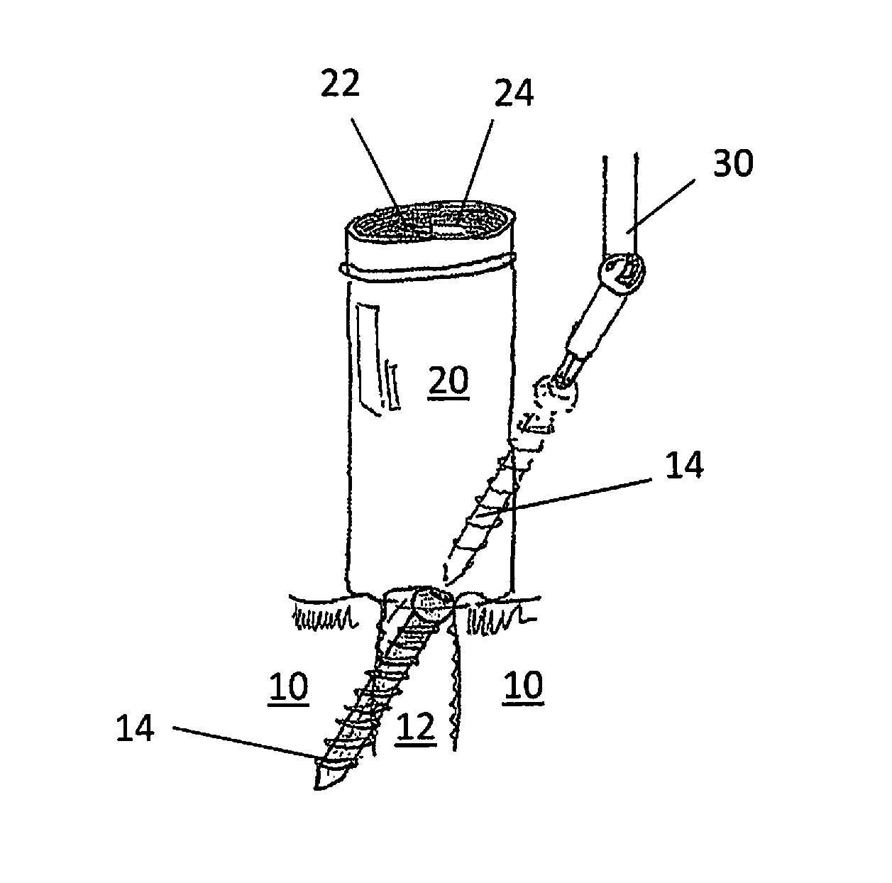 Surgical Devices for Access to Surgical Sites