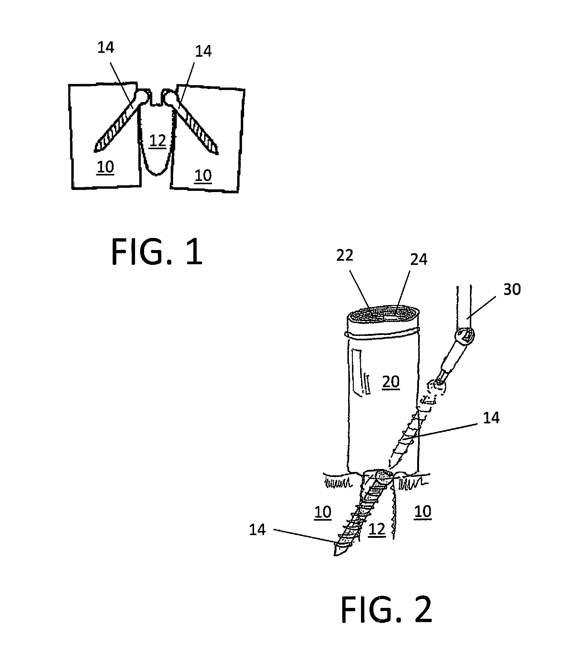 Surgical Devices for Access to Surgical Sites